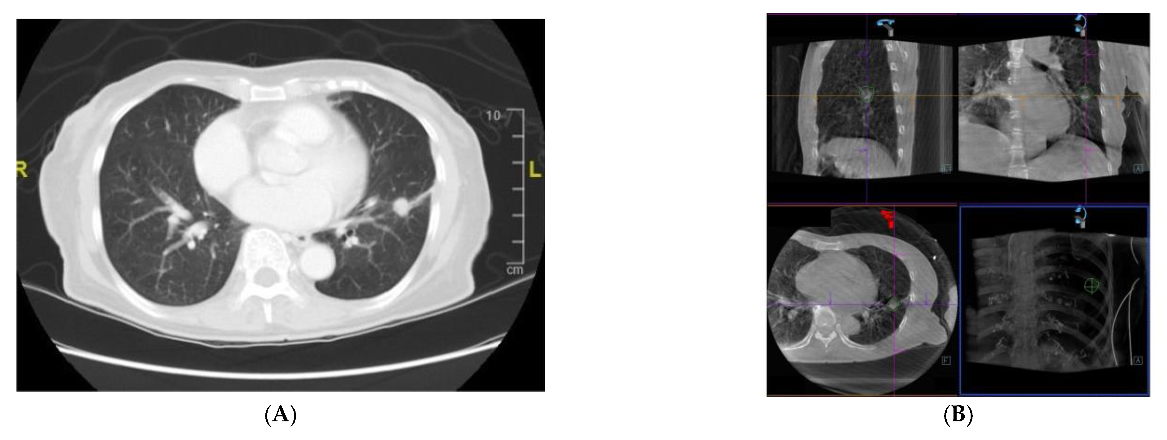 Diagnostics 12 00041 g002a Diagnostics 12 00041 g002a