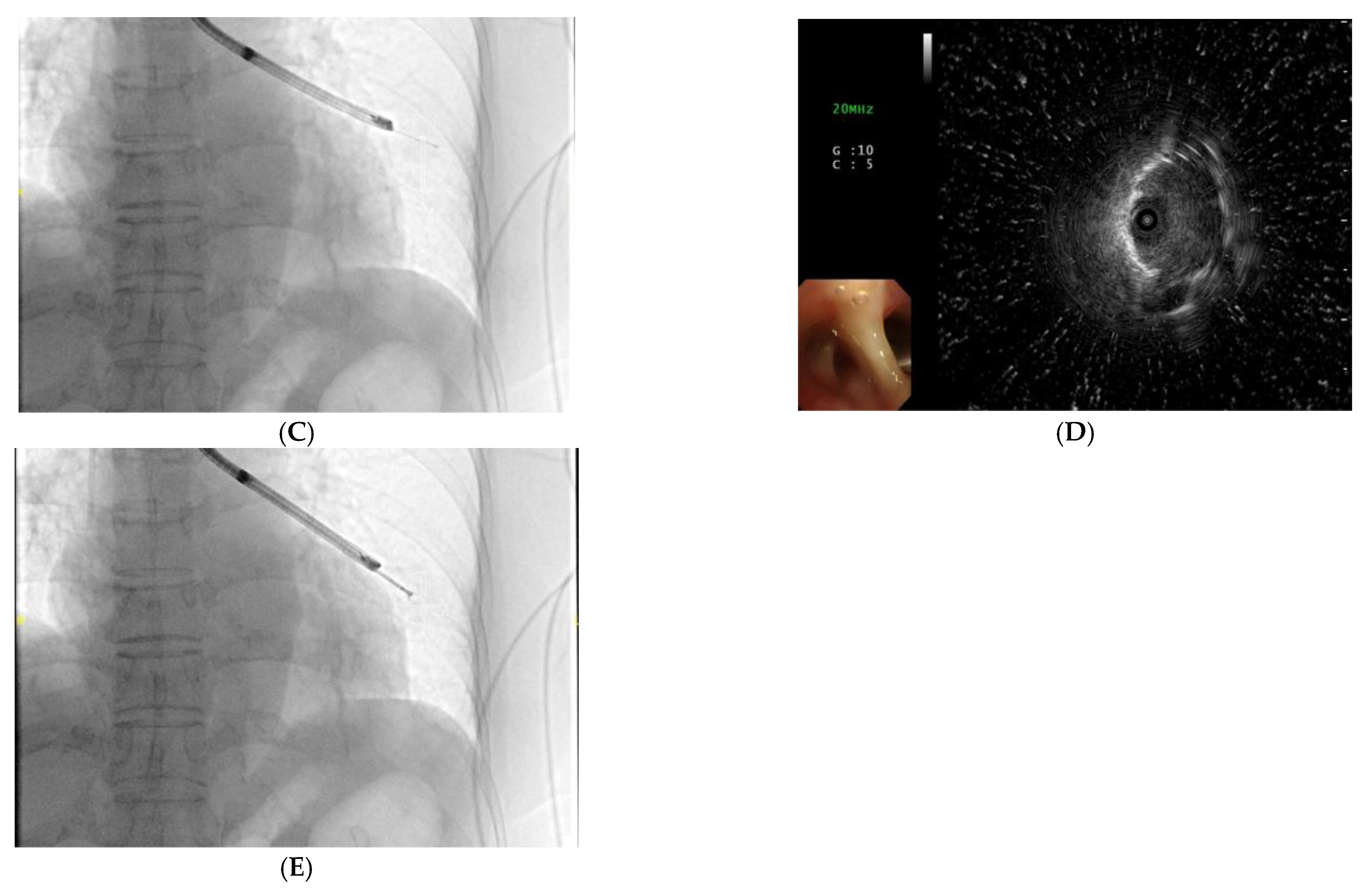 Diagnostics 12 00041 g002b Diagnostics 12 00041 g002b