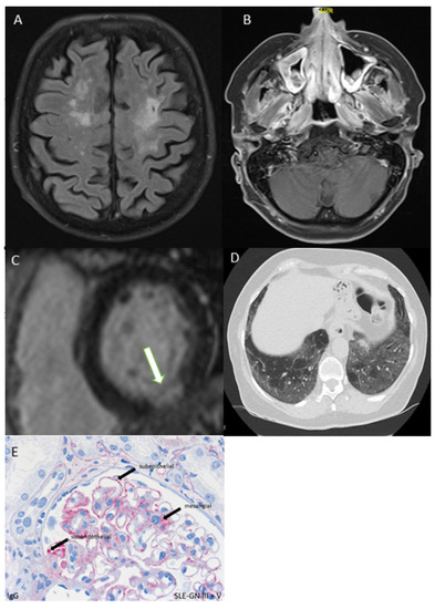 Diagnostics 12 00067 g003 550