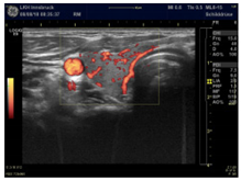 Diagnostics 12 00107 i002