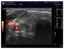 Diagnostics 12 00107 i003