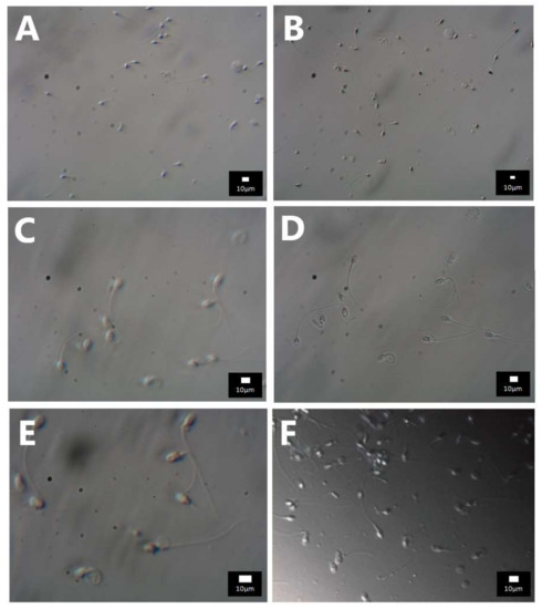 Diagnostics 12 00192 g0a3