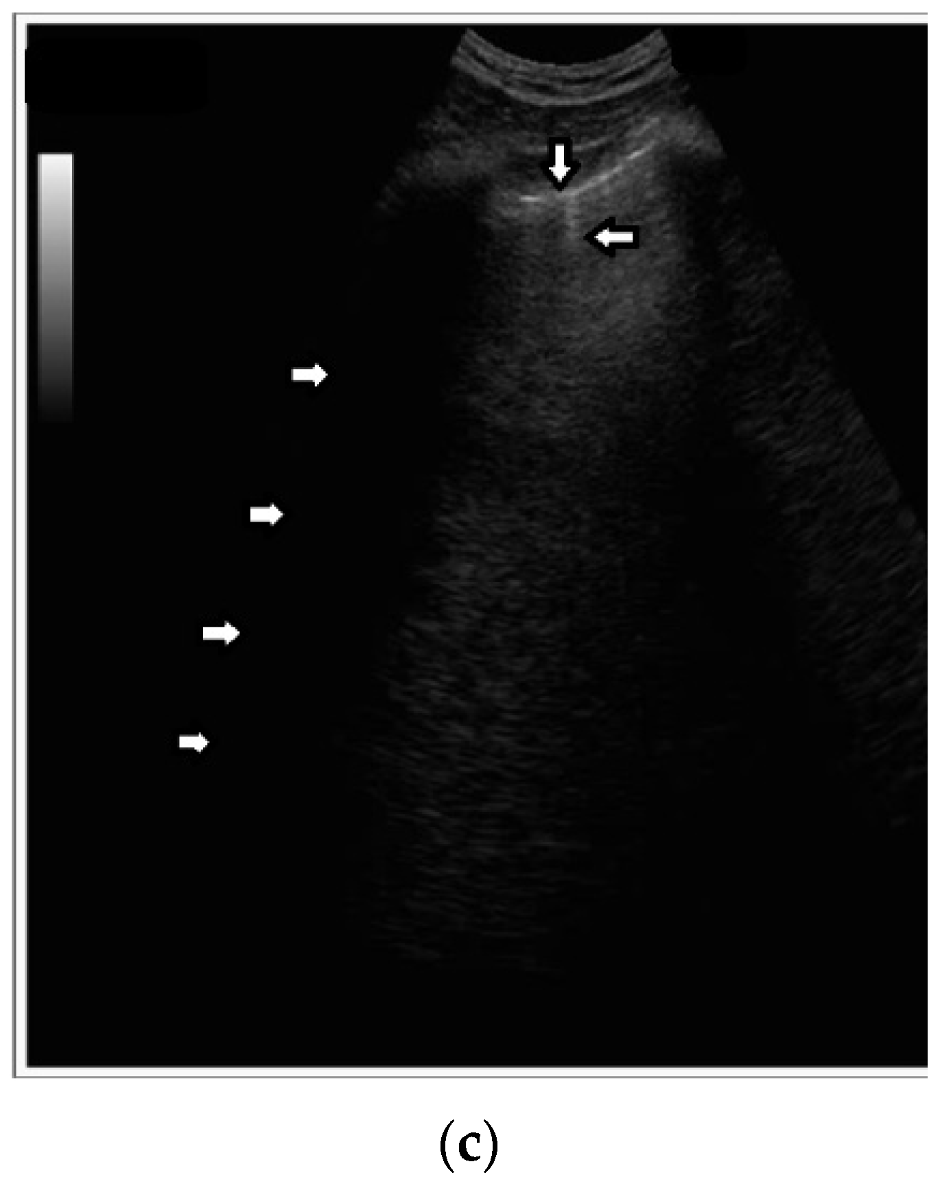 Diagnostics 12 00215 g005b