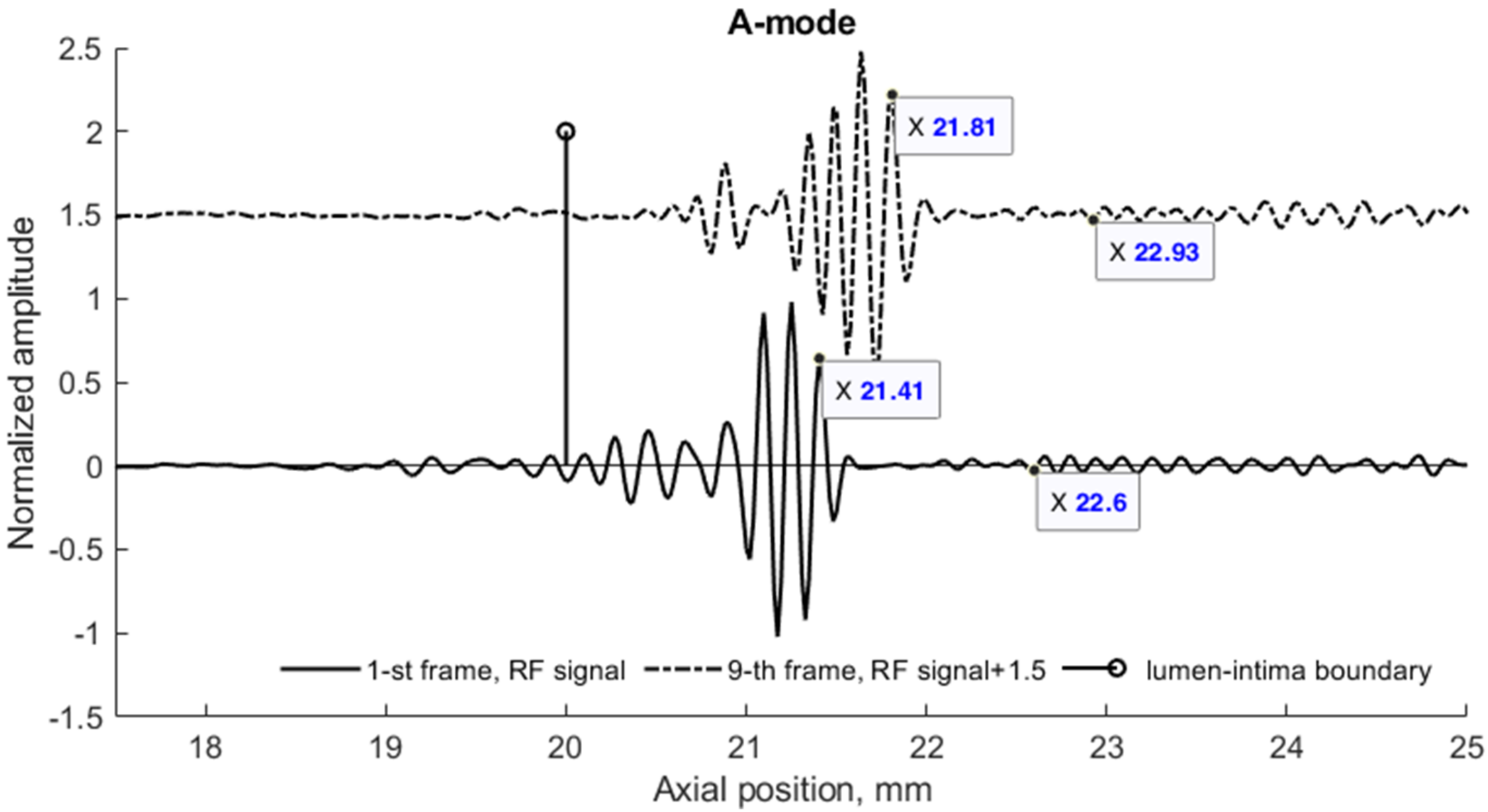 Diagnostics 12 00232 g009