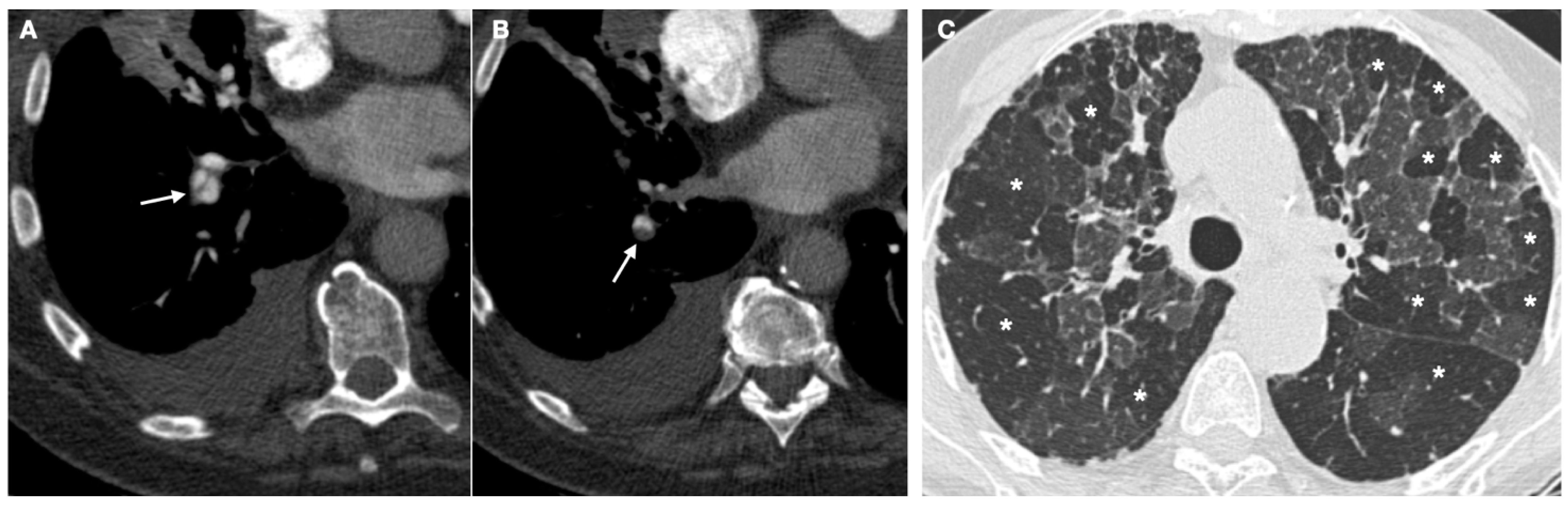 Diagnostics 12 00235 g001