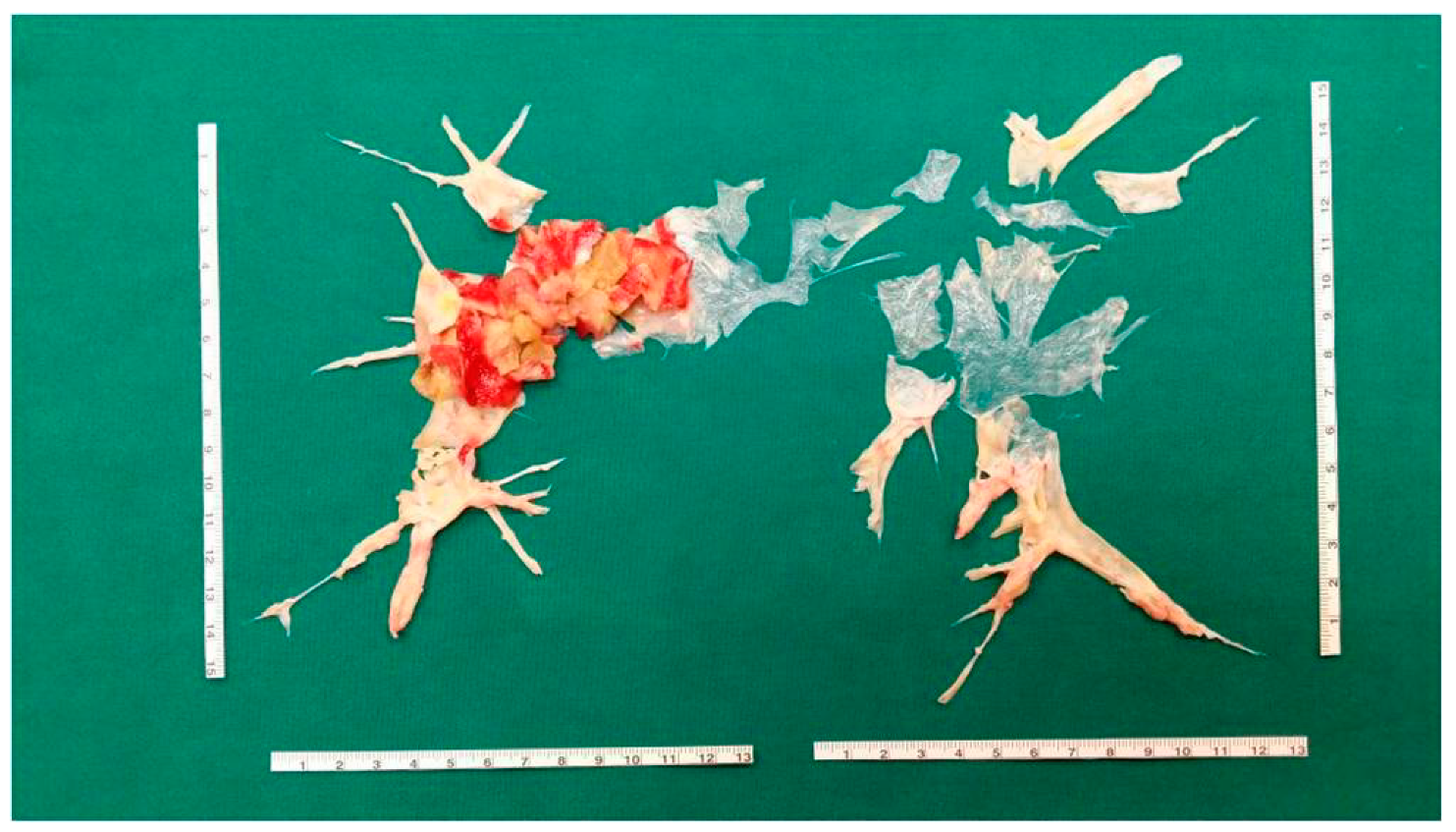 Diagnostics 12 00235 g003