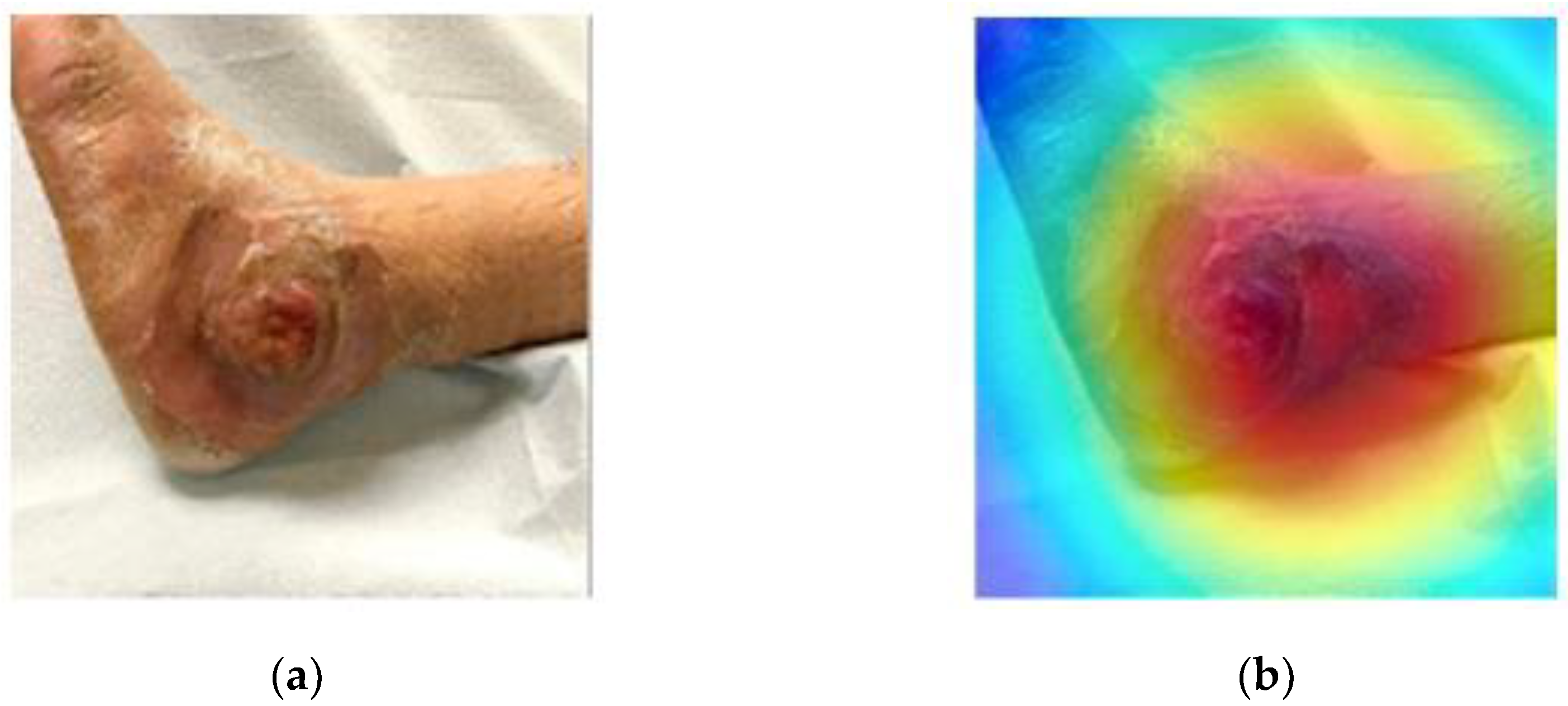 Diagnostics 12 00237 g004