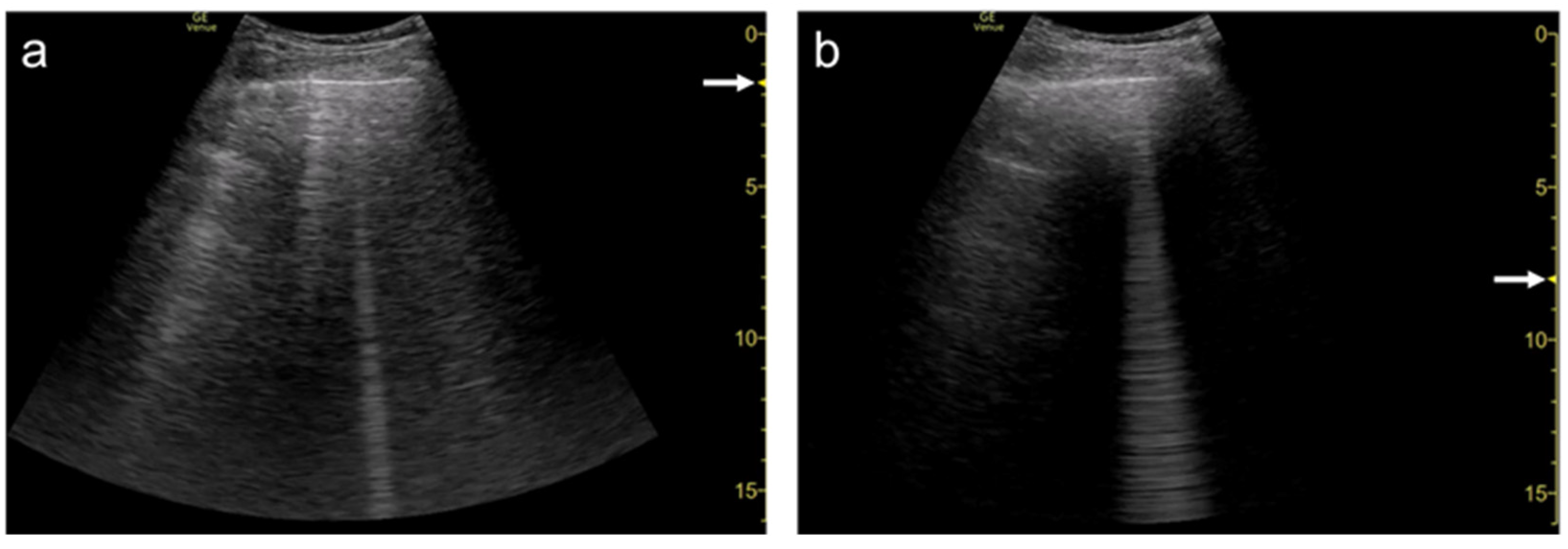 Diagnostics 12 00252 g007