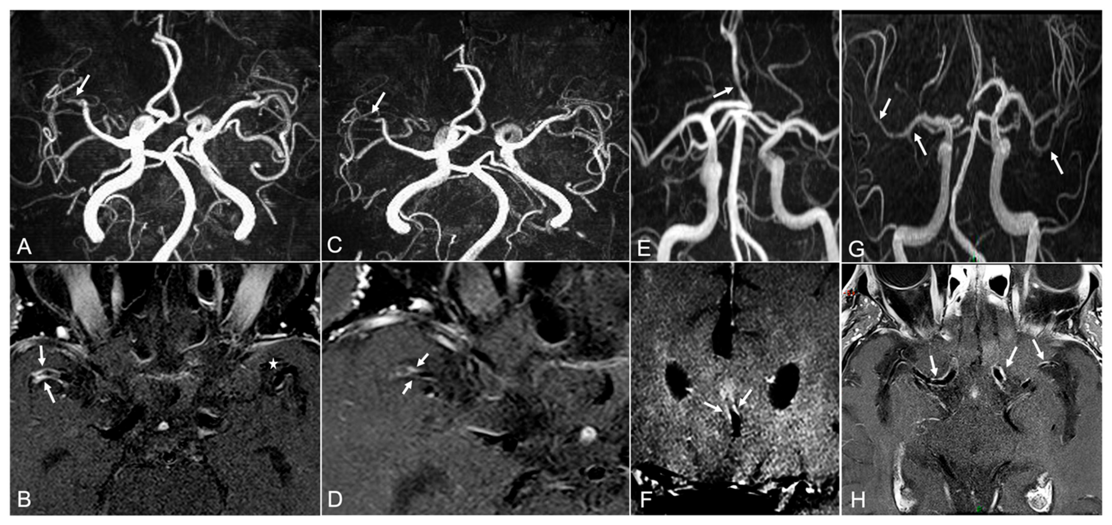 Diagnostics 12 00258 g001
