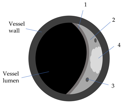 Diagnostics 12 00258 i001