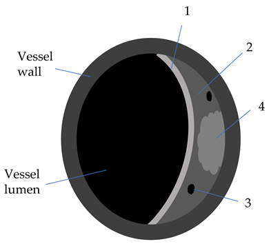 Diagnostics 12 00258 i003