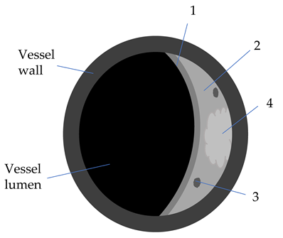 Diagnostics 12 00258 i004