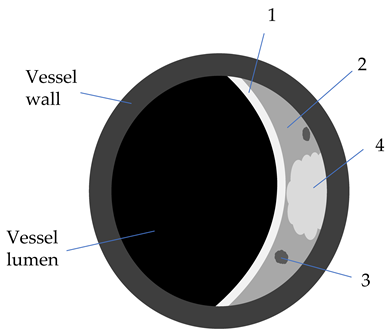 Diagnostics 12 00258 i005