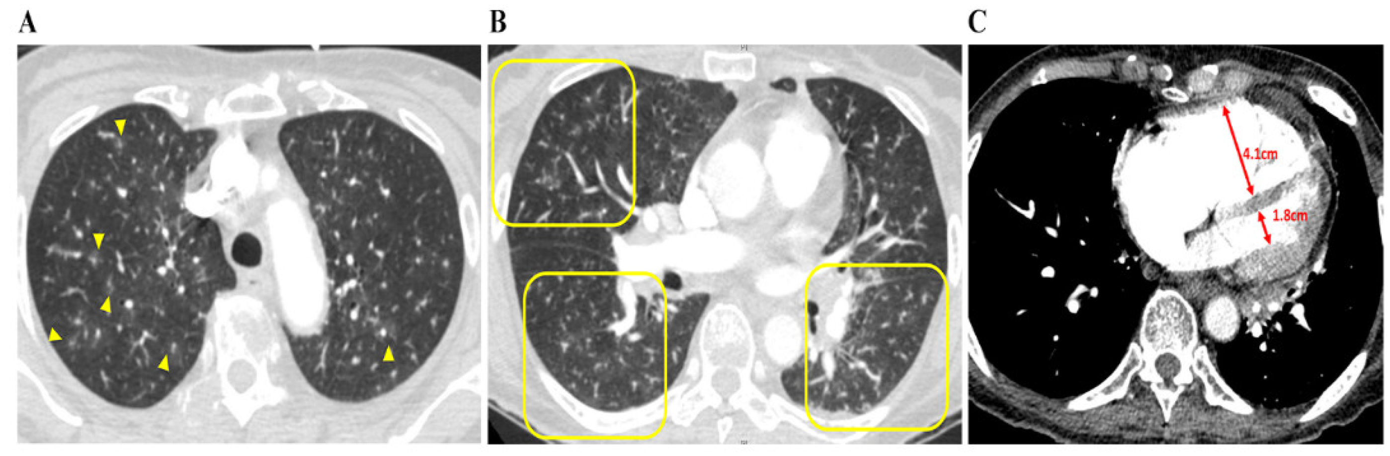 Diagnostics 12 00259 g002