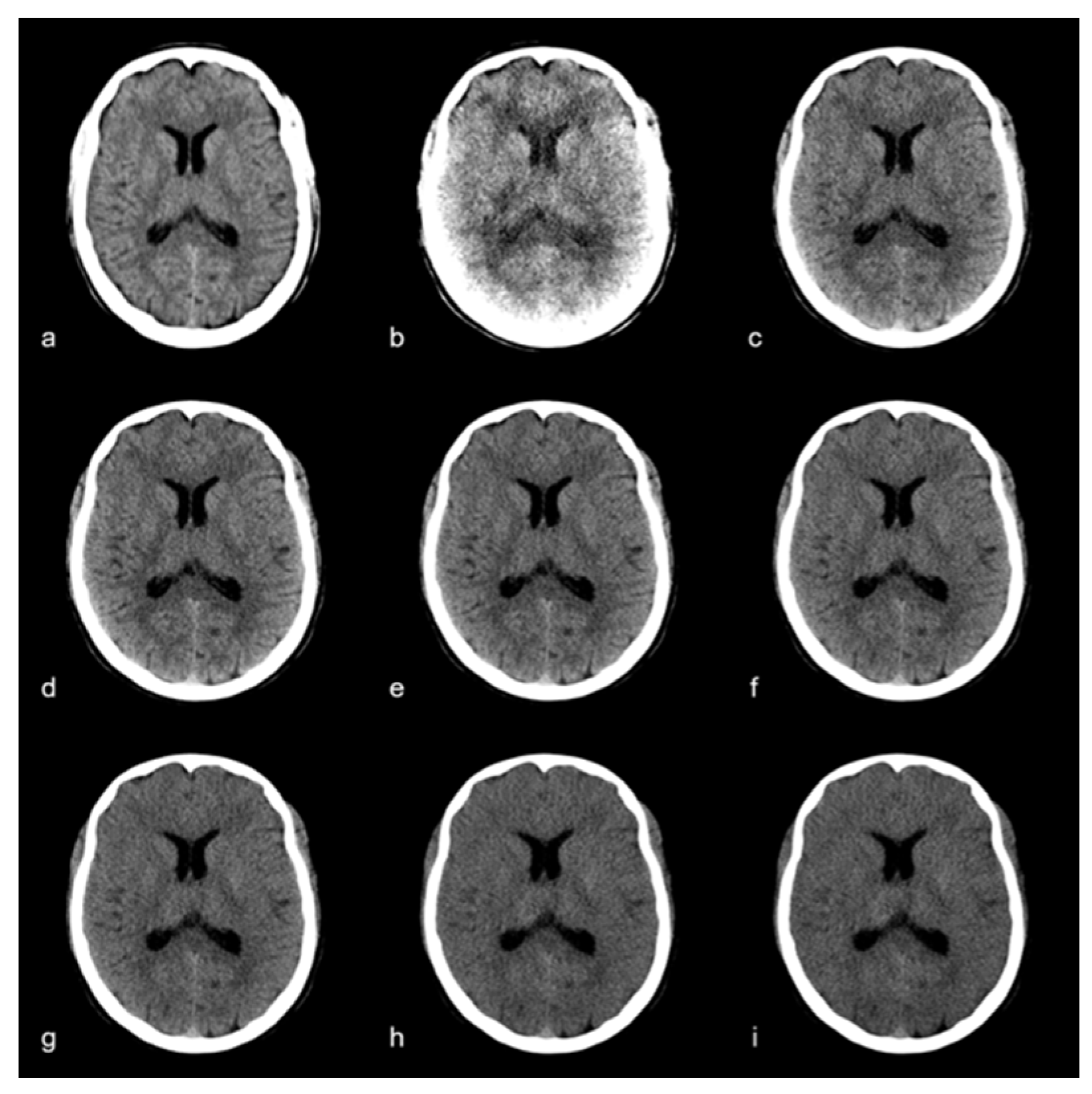 Diagnostics 12 00265 g001