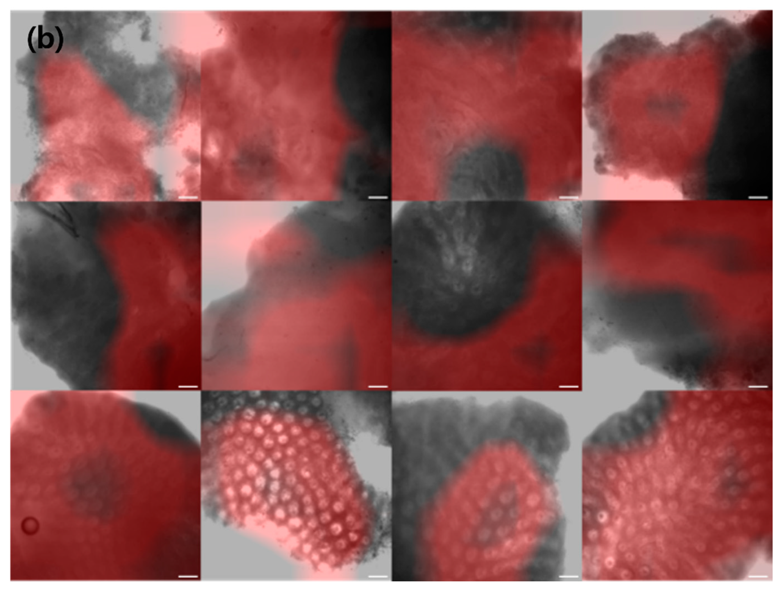 Diagnostics 12 00288 g002b