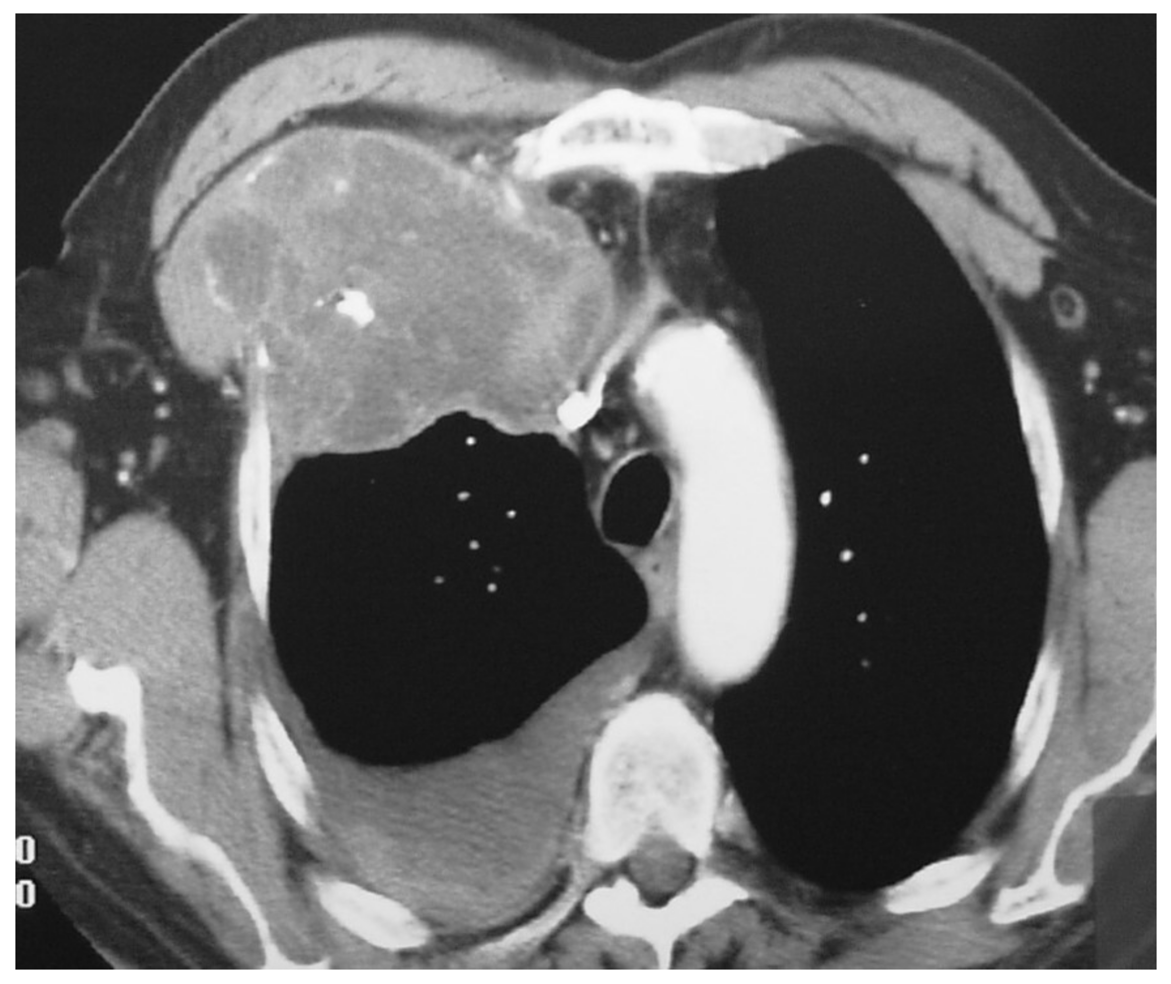 Diagnostics 12 00292 g001