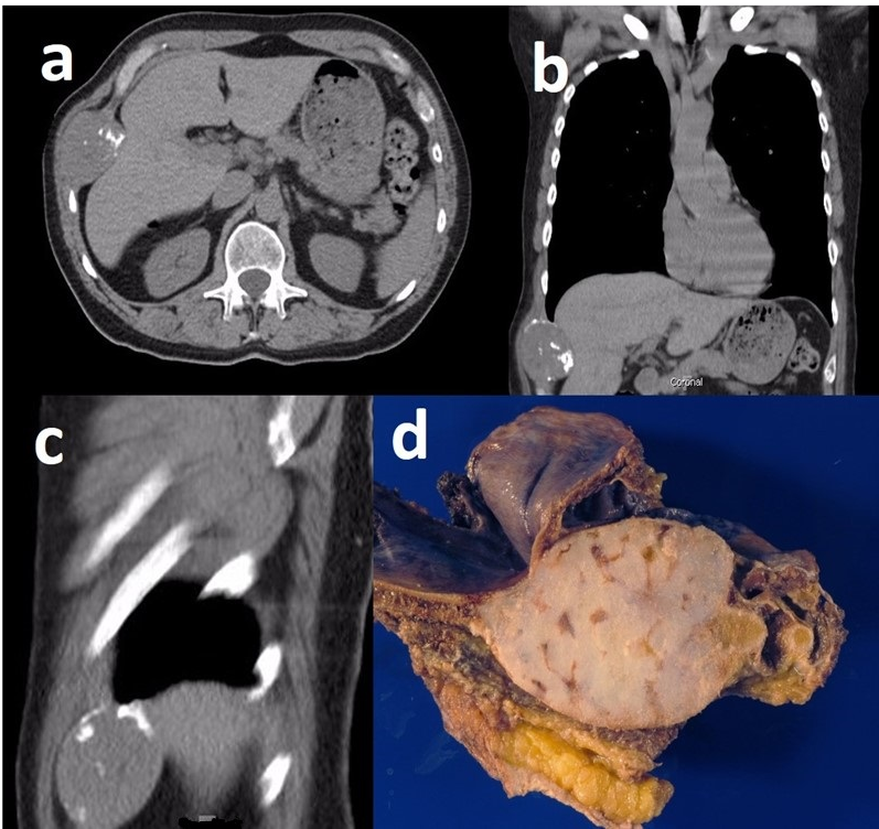Diagnostics 12 00292 g004