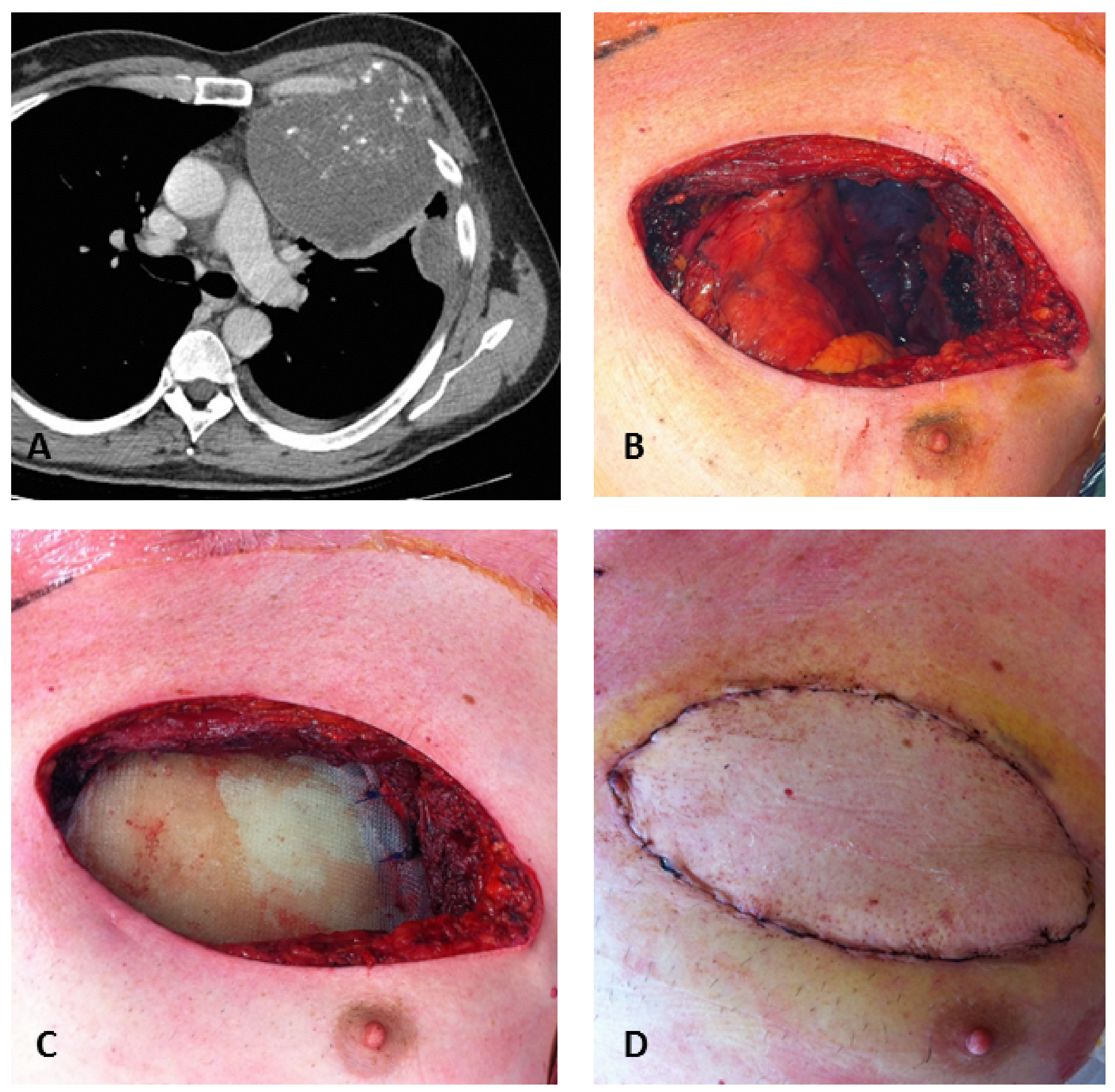 Diagnostics 12 00292 g005