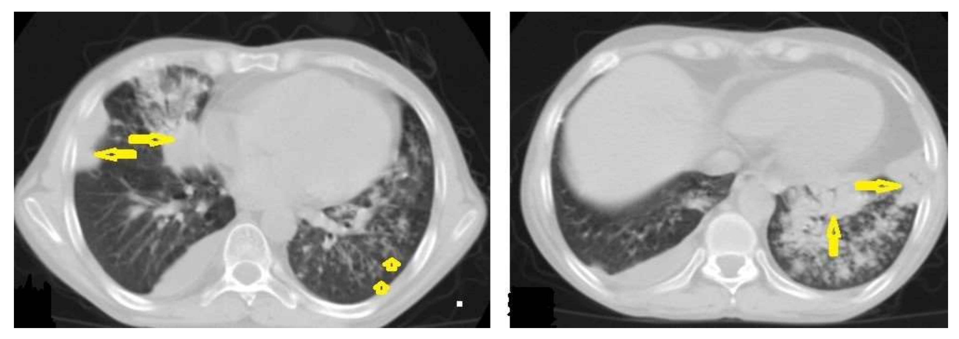 Diagnostics 12 00306 g002