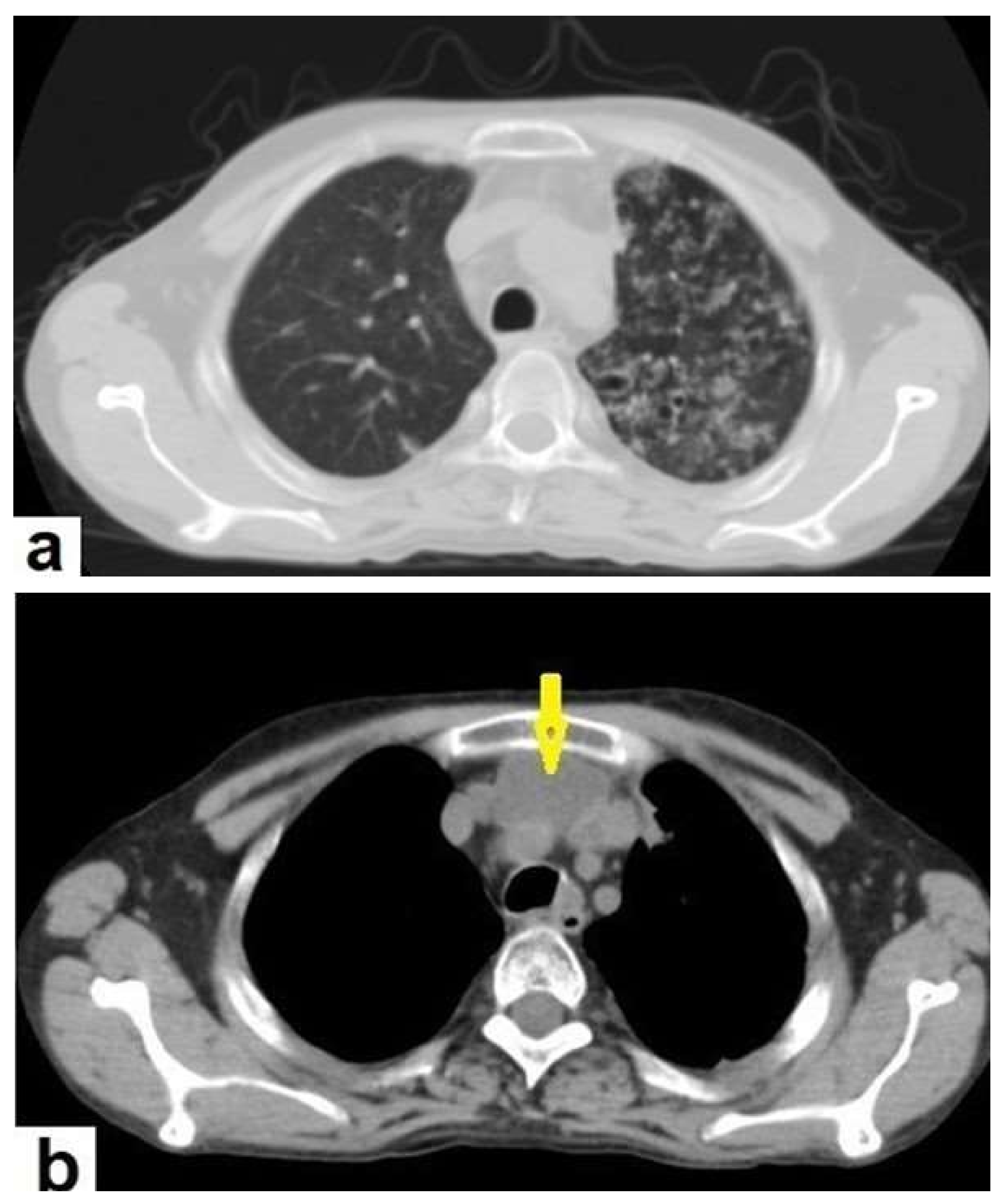 Diagnostics 12 00306 g005