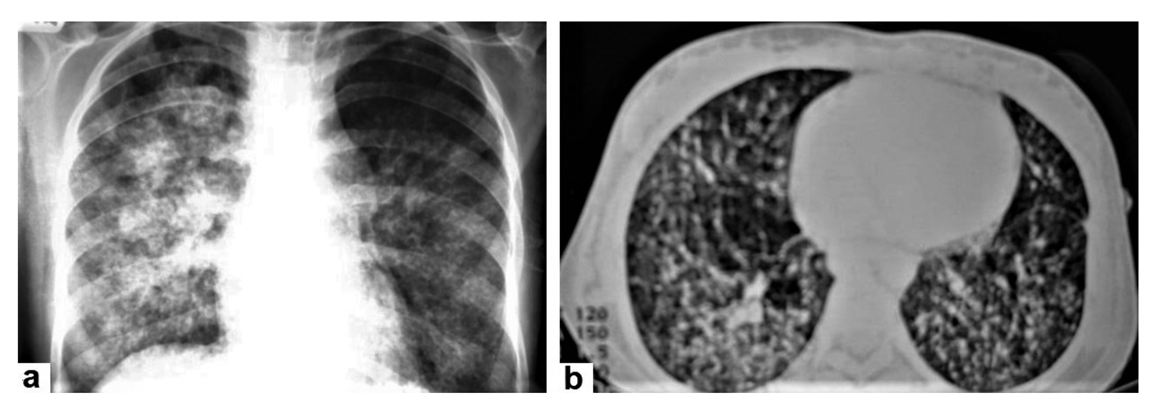 Diagnostics 12 00306 g006