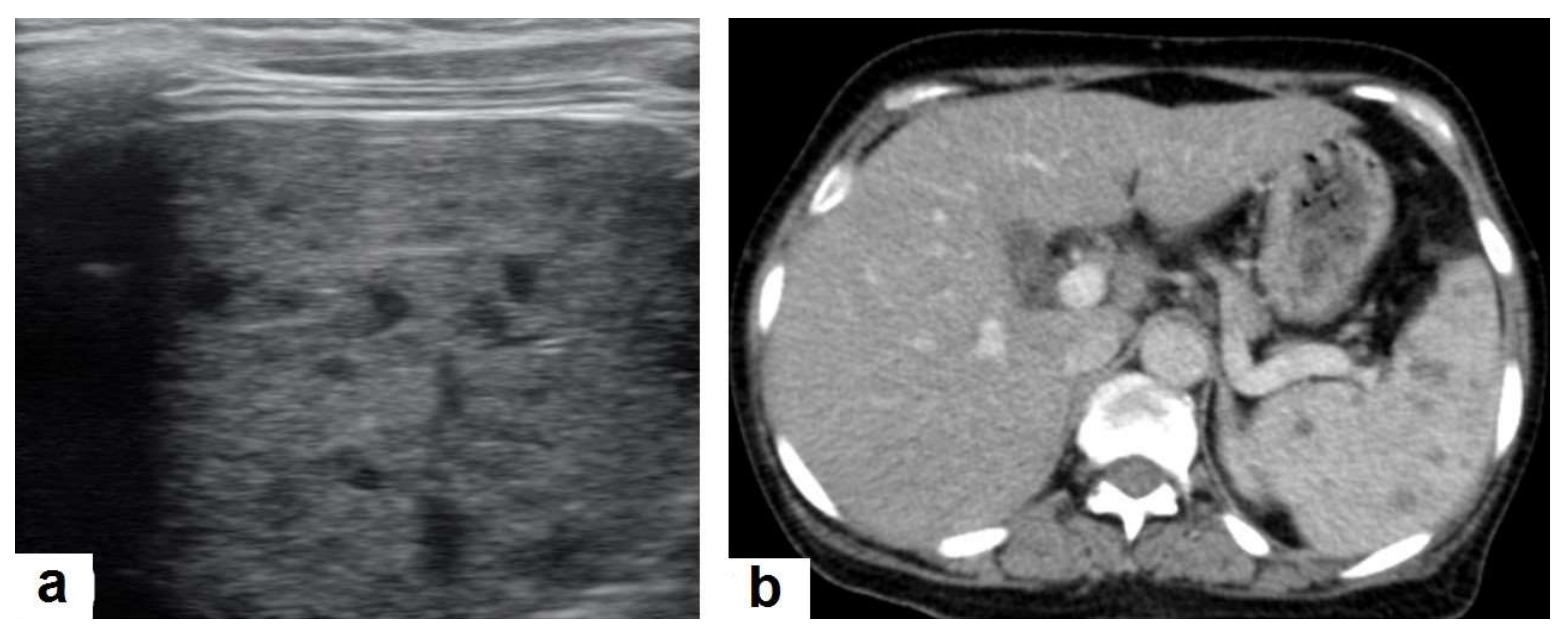 Diagnostics 12 00306 g007