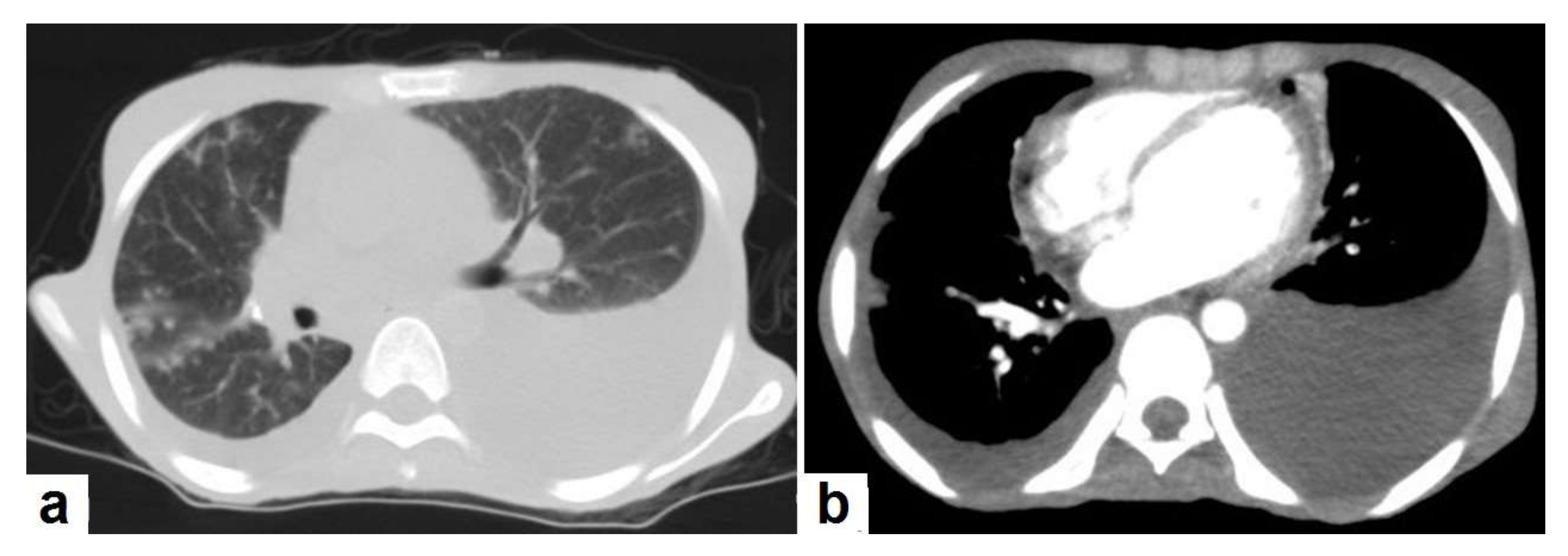 Diagnostics 12 00306 g008