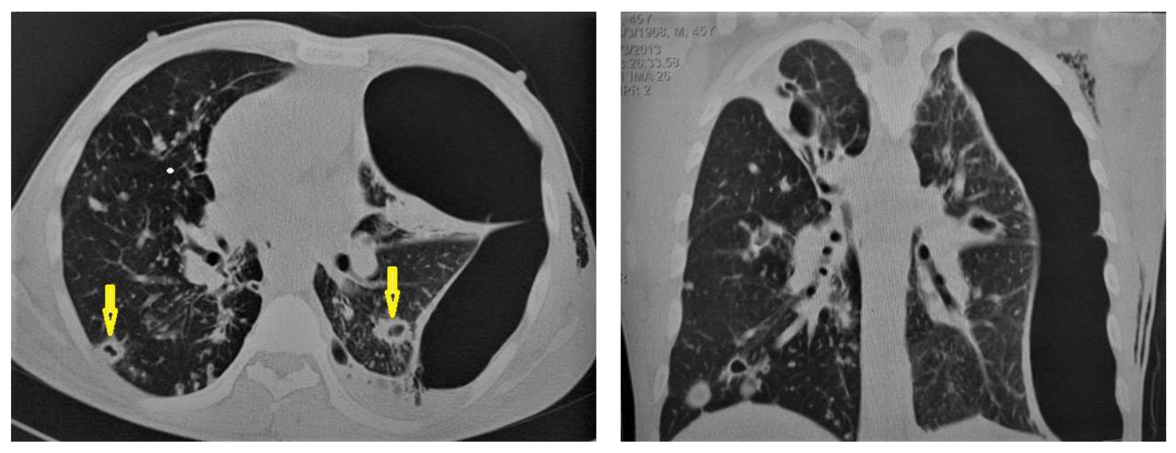 Diagnostics 12 00306 g011