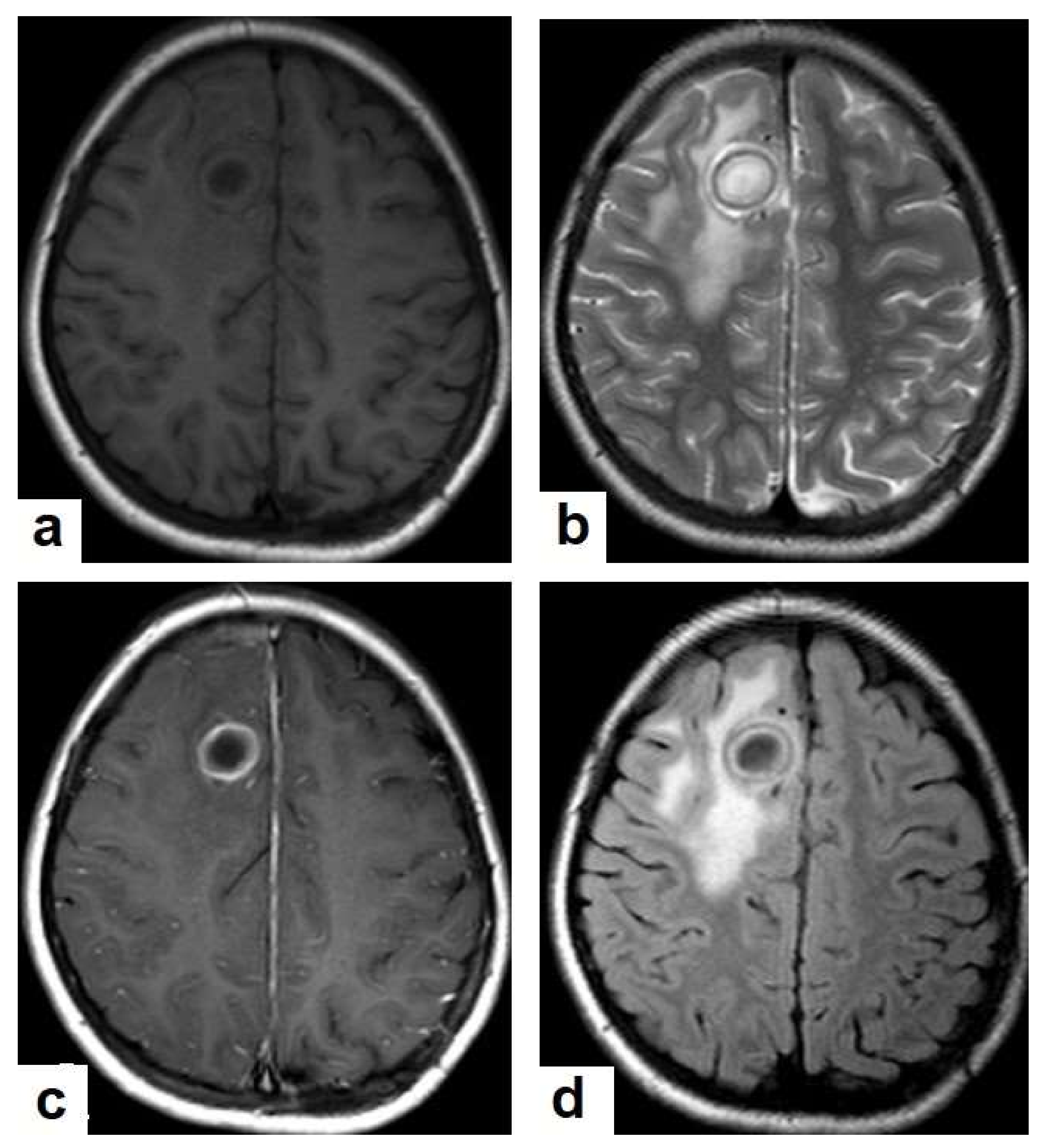 Diagnostics 12 00306 g016