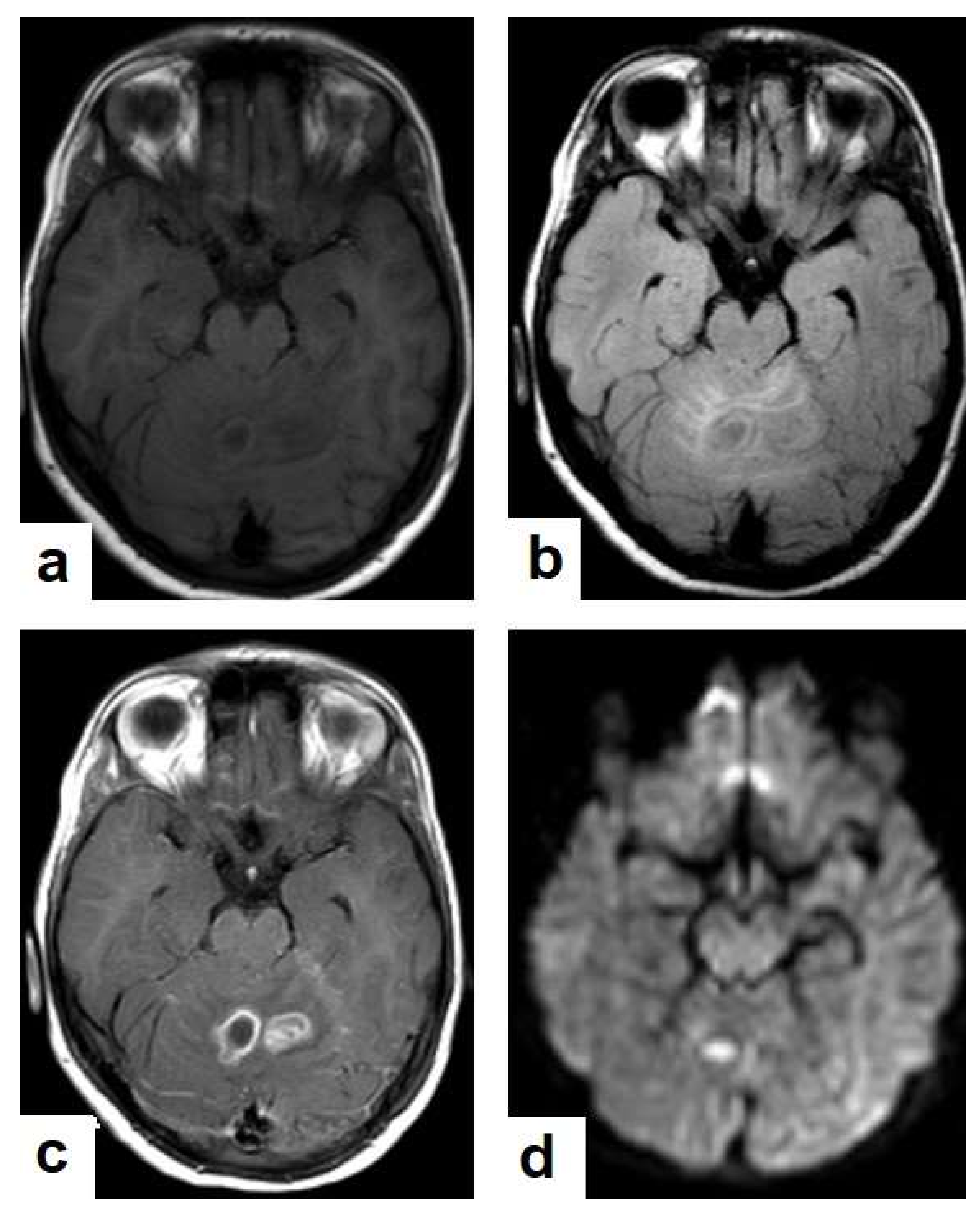 Diagnostics 12 00306 g017