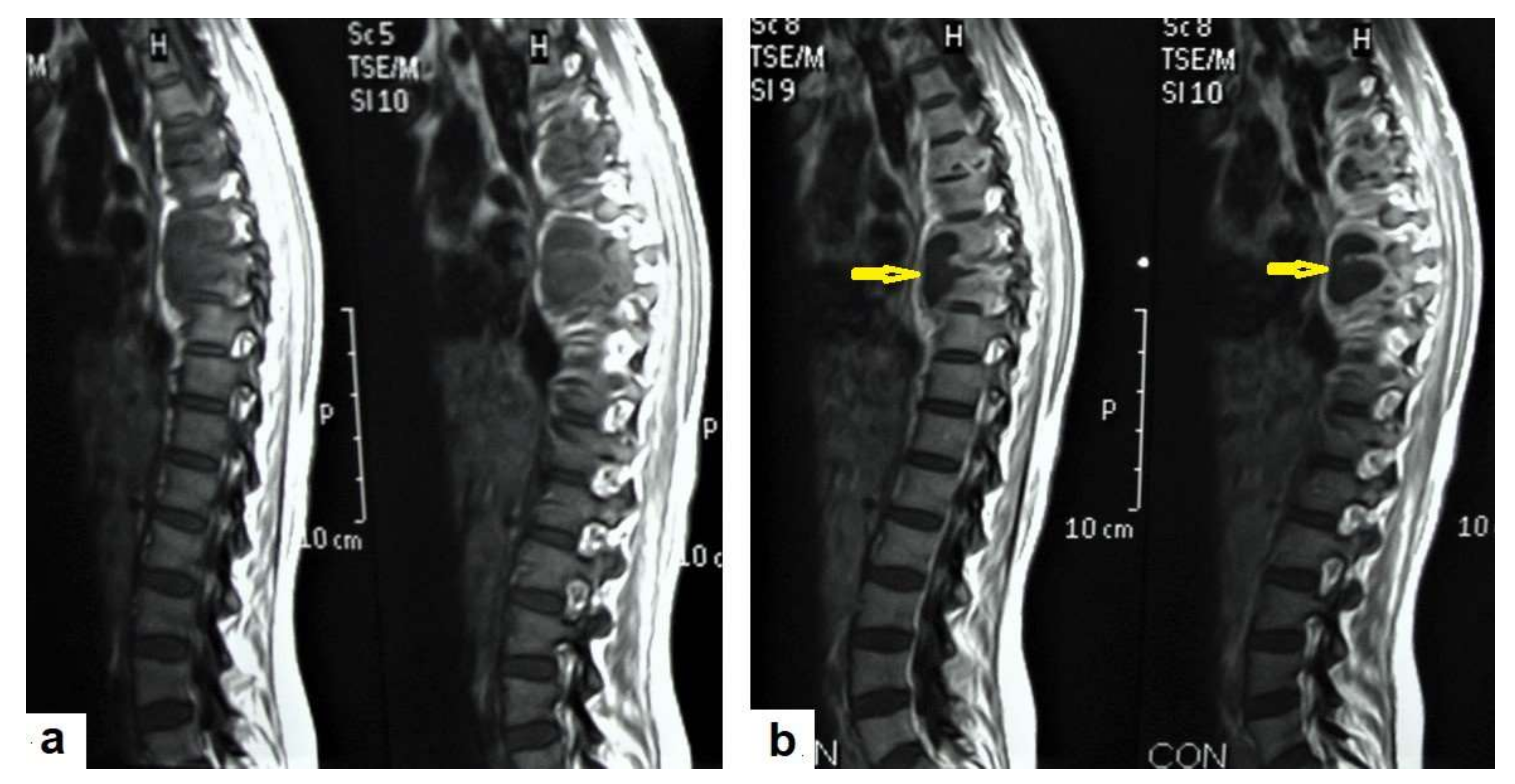 Diagnostics 12 00306 g018