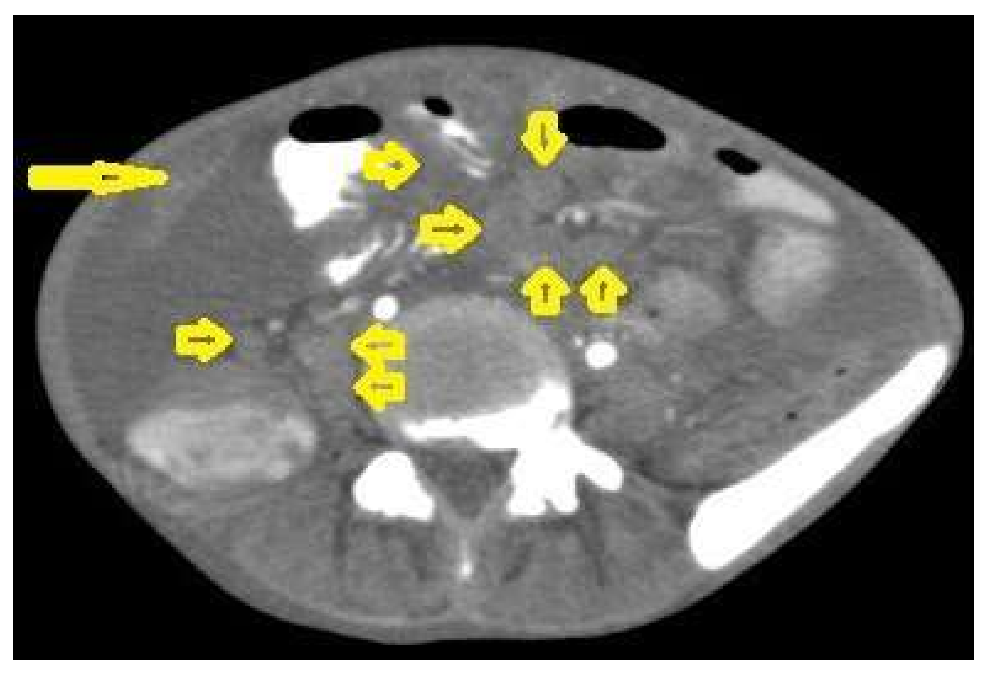 Diagnostics 12 00306 g020