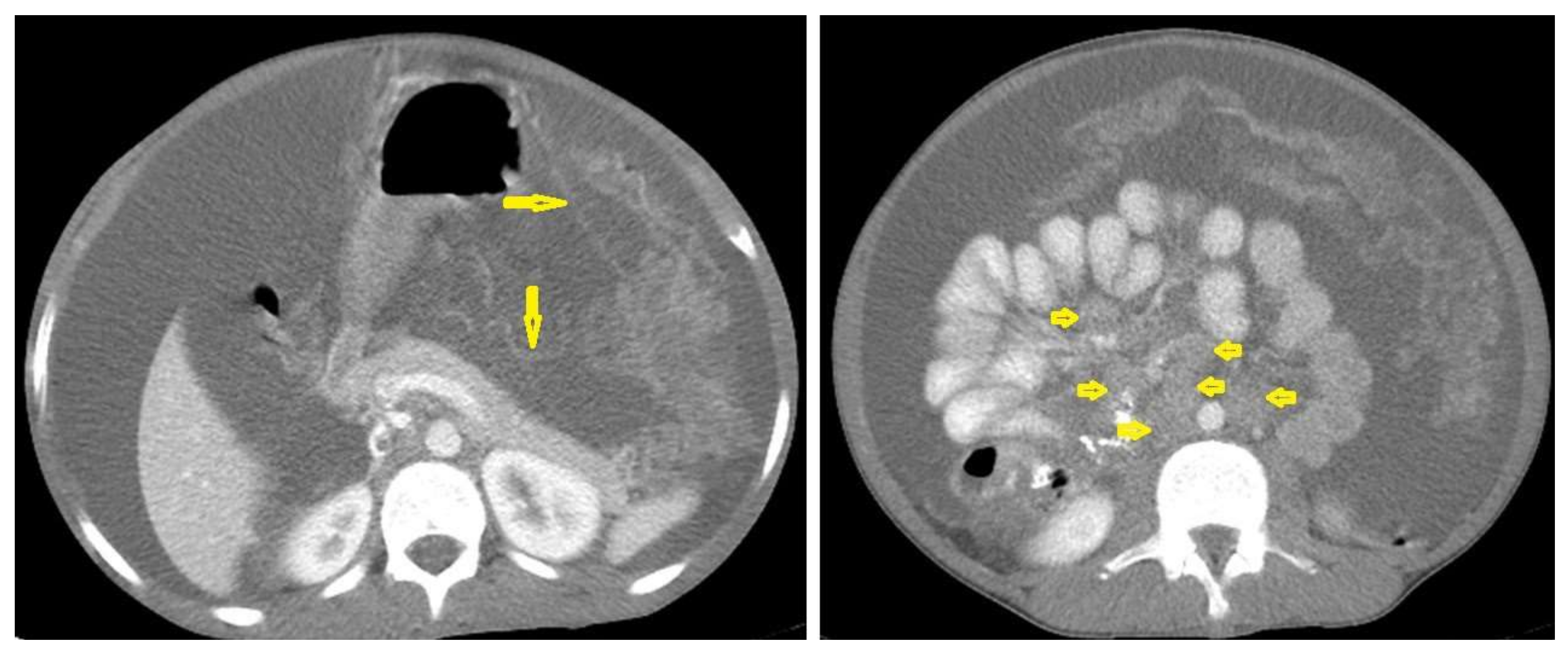 Diagnostics 12 00306 g021