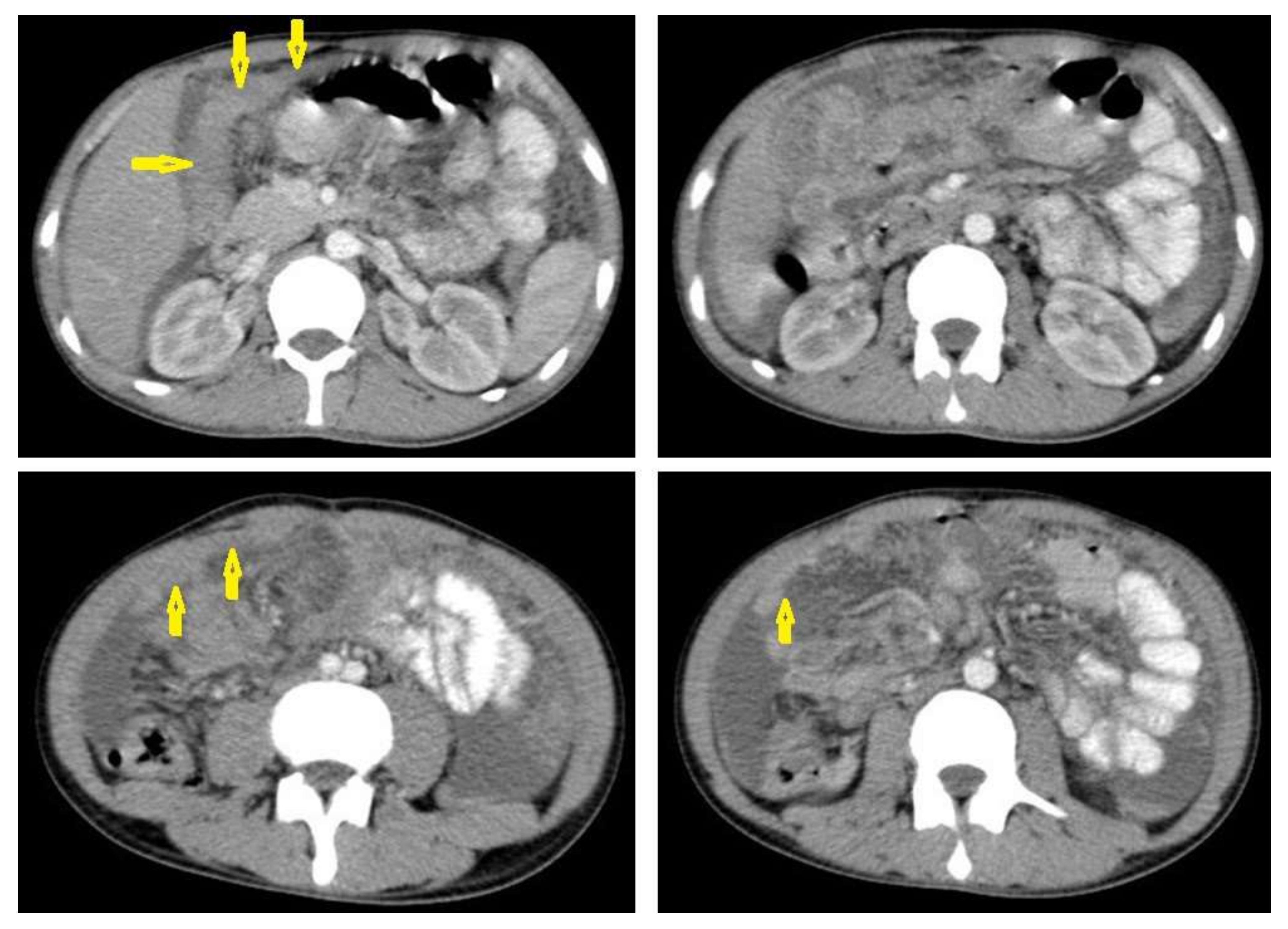 Diagnostics 12 00306 g022