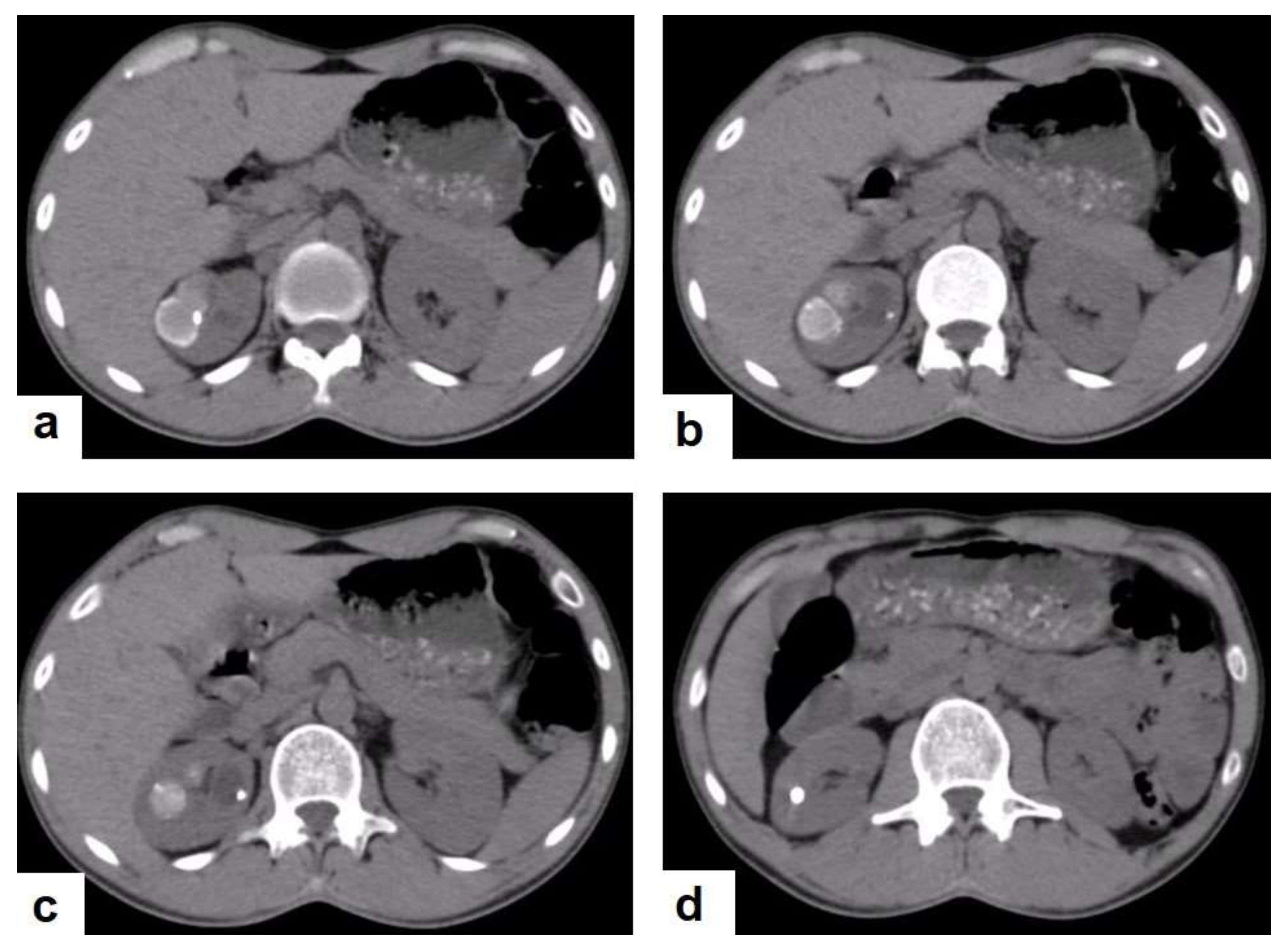 Diagnostics 12 00306 g023