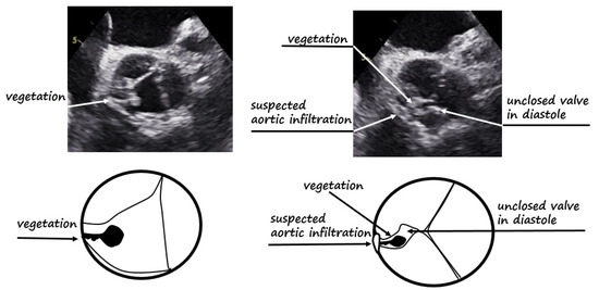 Diagnostics 12 00327 g001 550