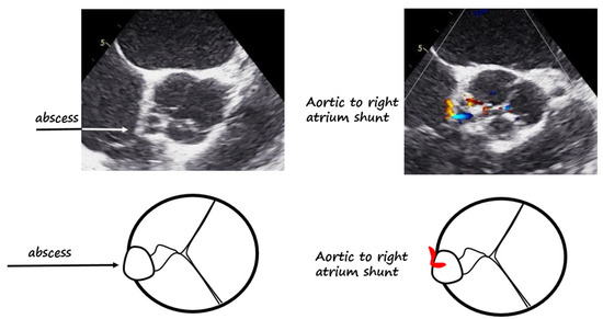 Diagnostics 12 00327 g002 550