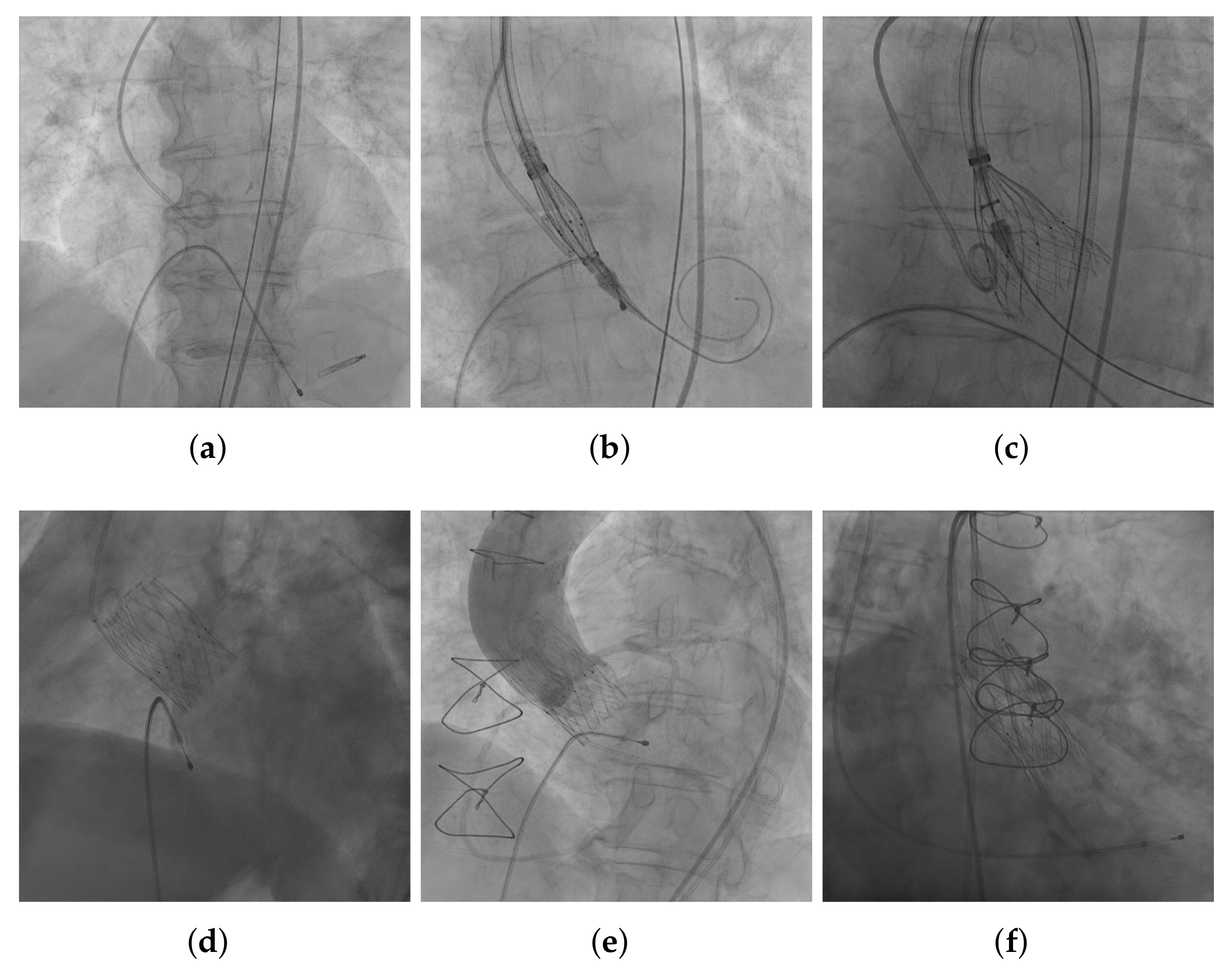 Diagnostics 12 00334 g002