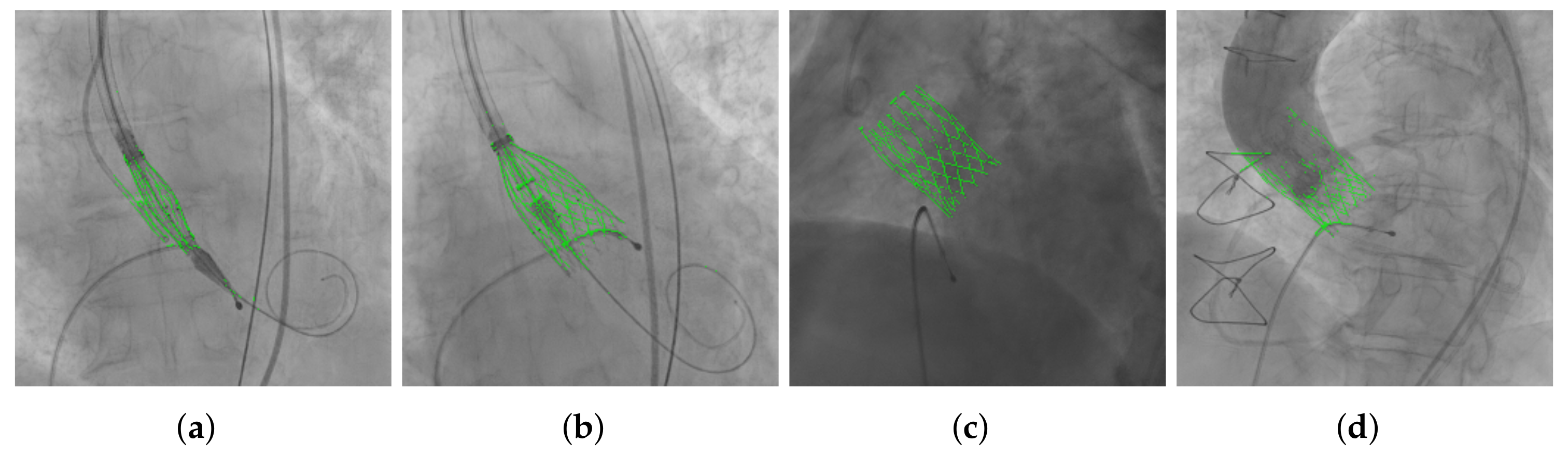 Diagnostics 12 00334 g004