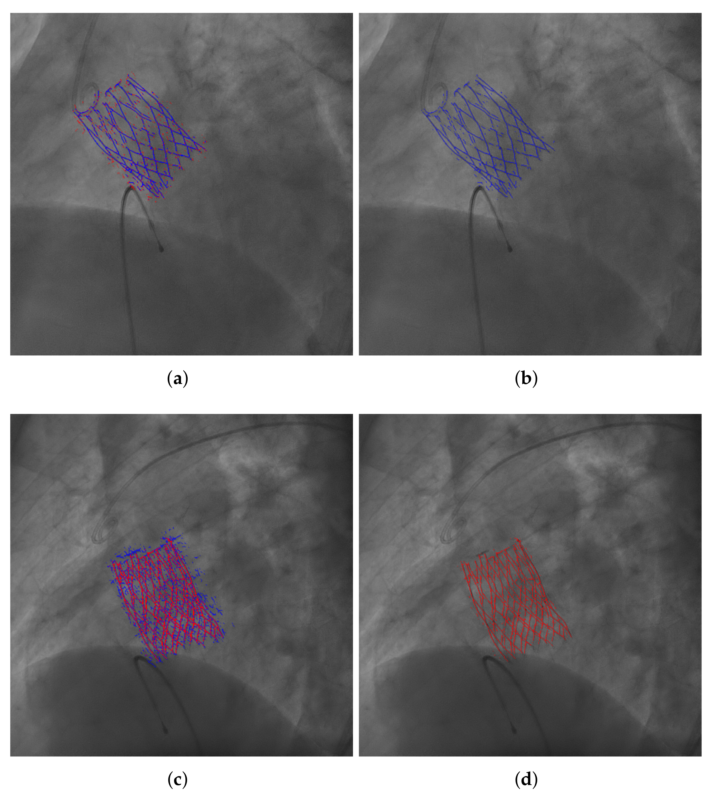 Diagnostics 12 00334 g007