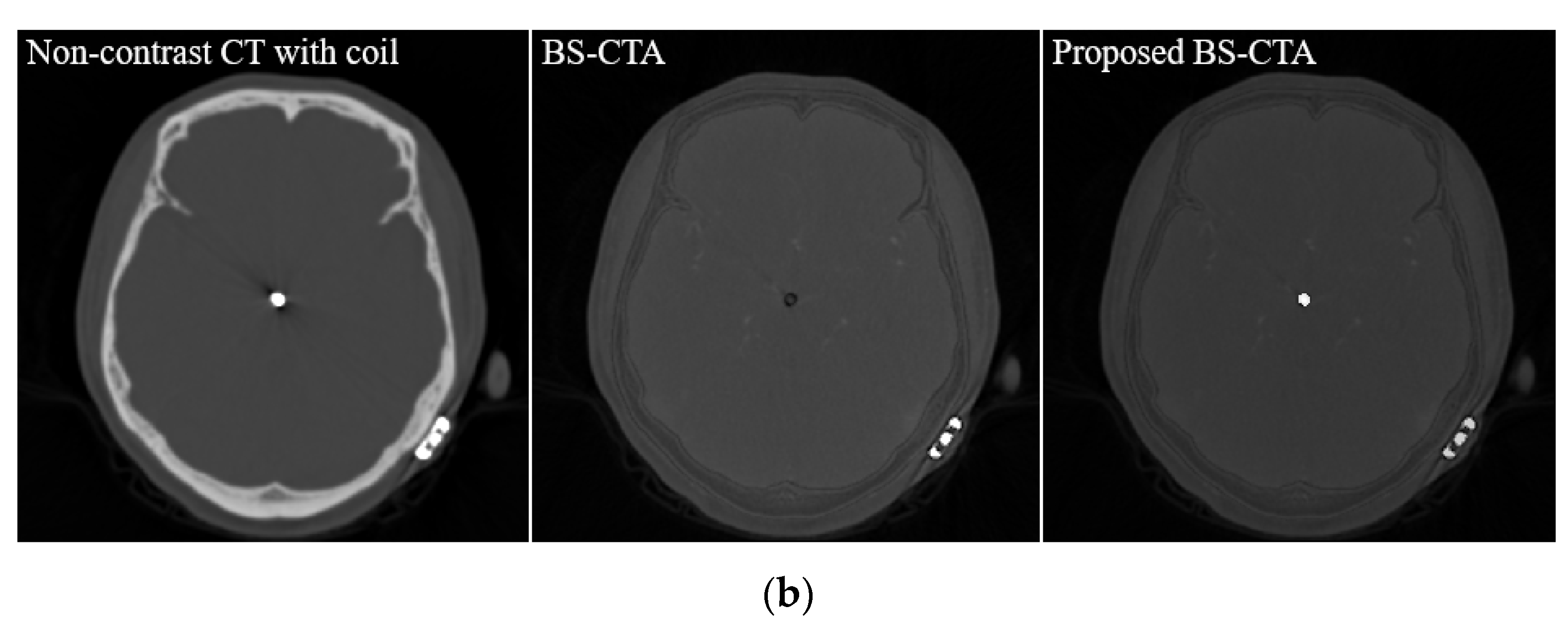 Diagnostics 12 00338 g007b