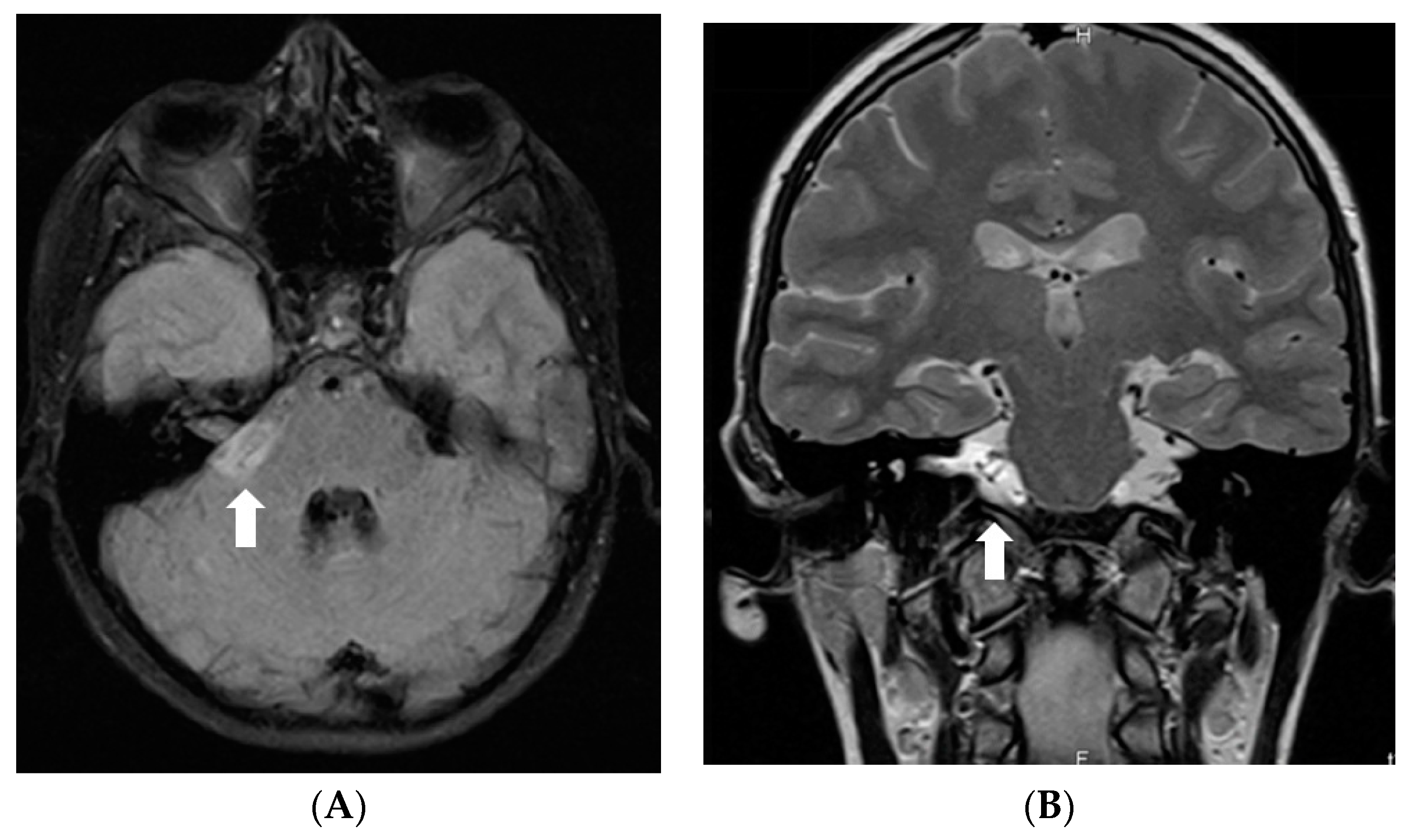 Diagnostics 12 00342 g001a