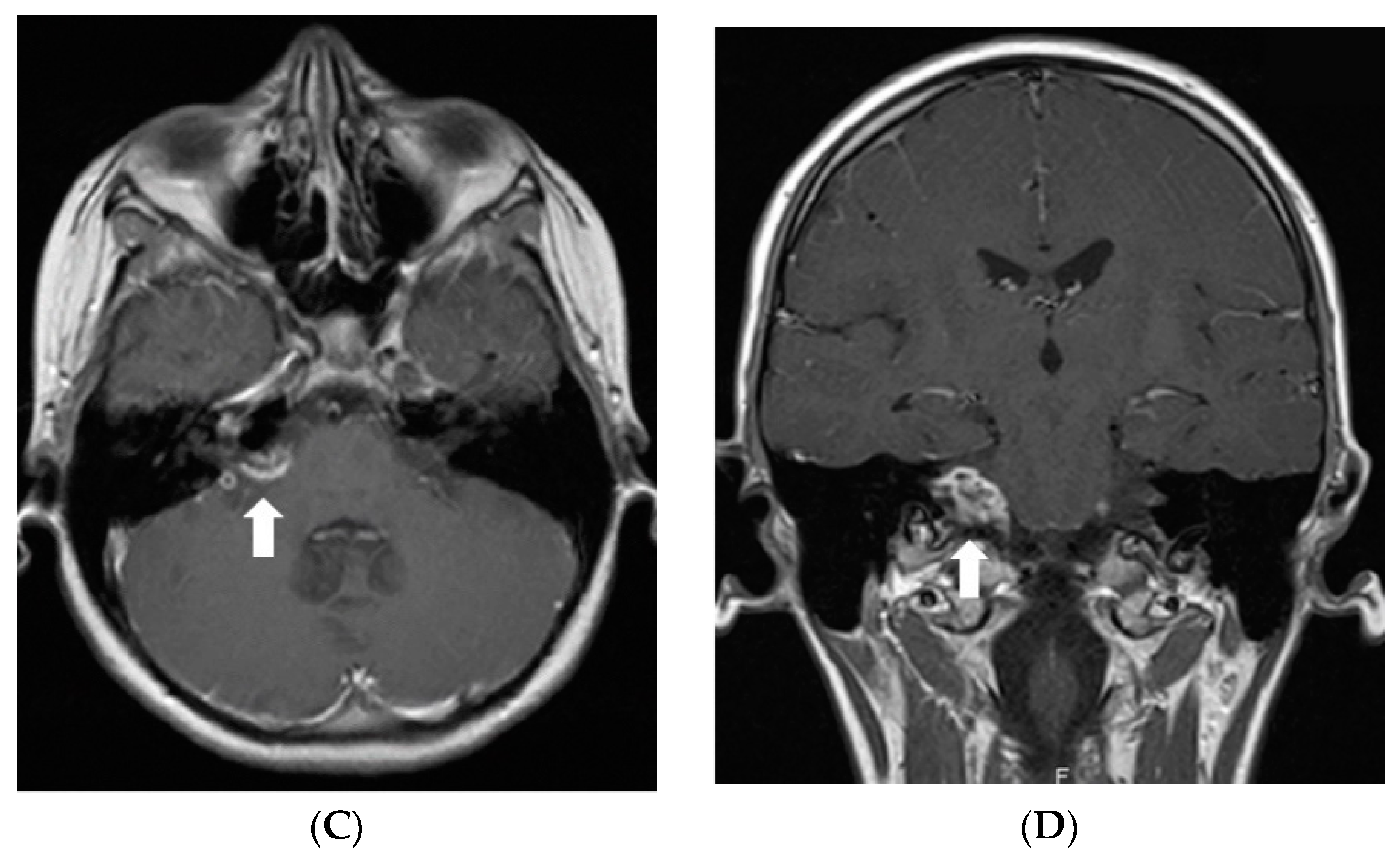 Diagnostics 12 00342 g001b