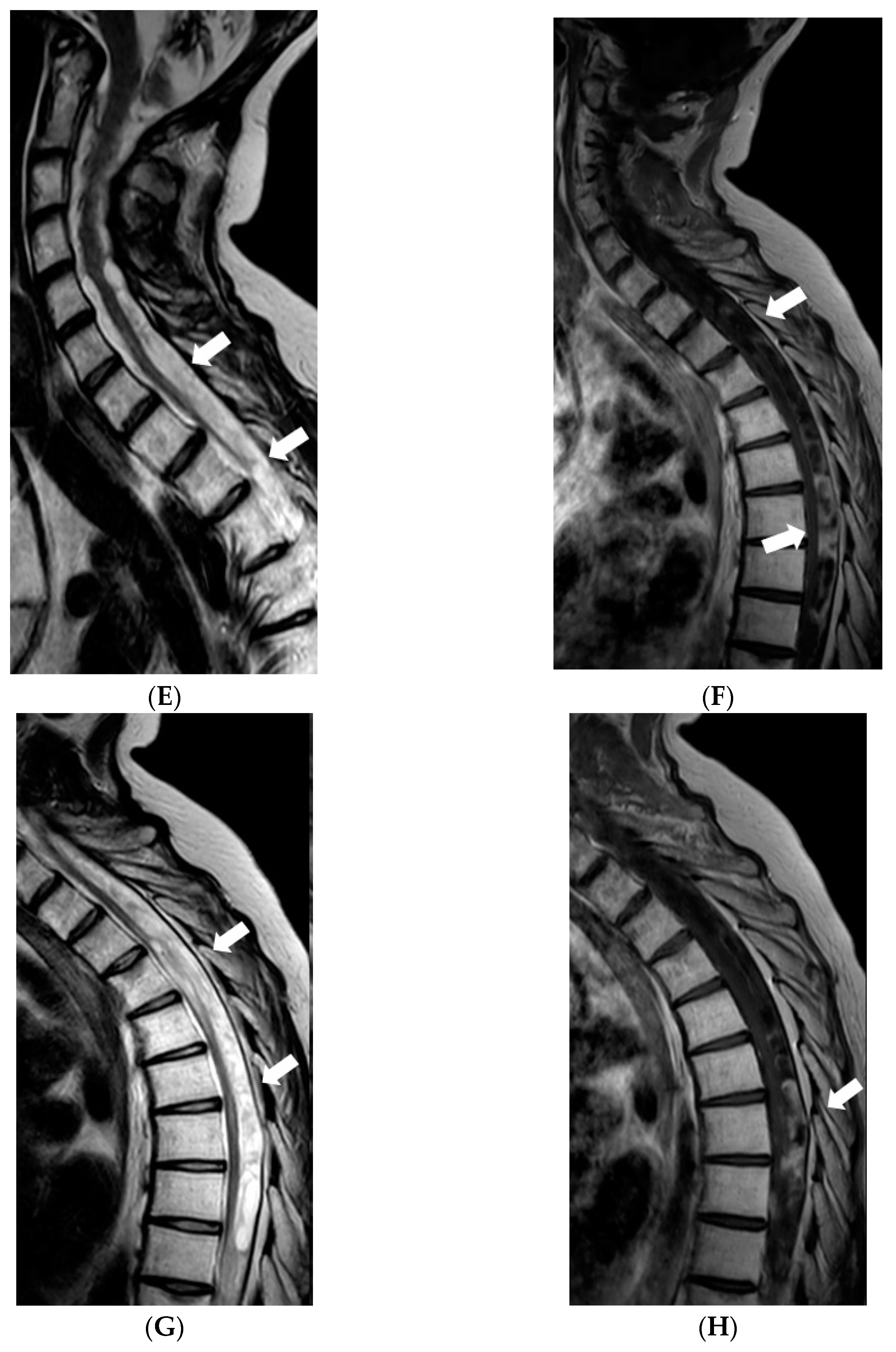 Diagnostics 12 00342 g006b