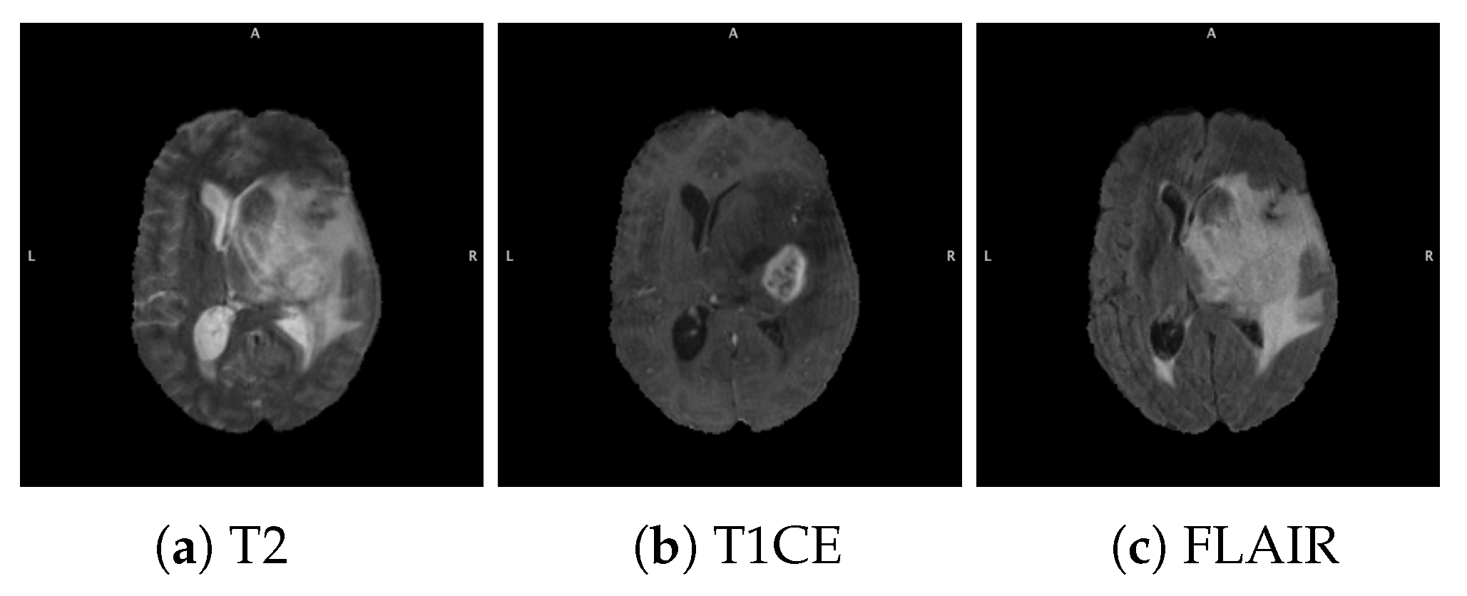 Diagnostics 12 00345 g002
