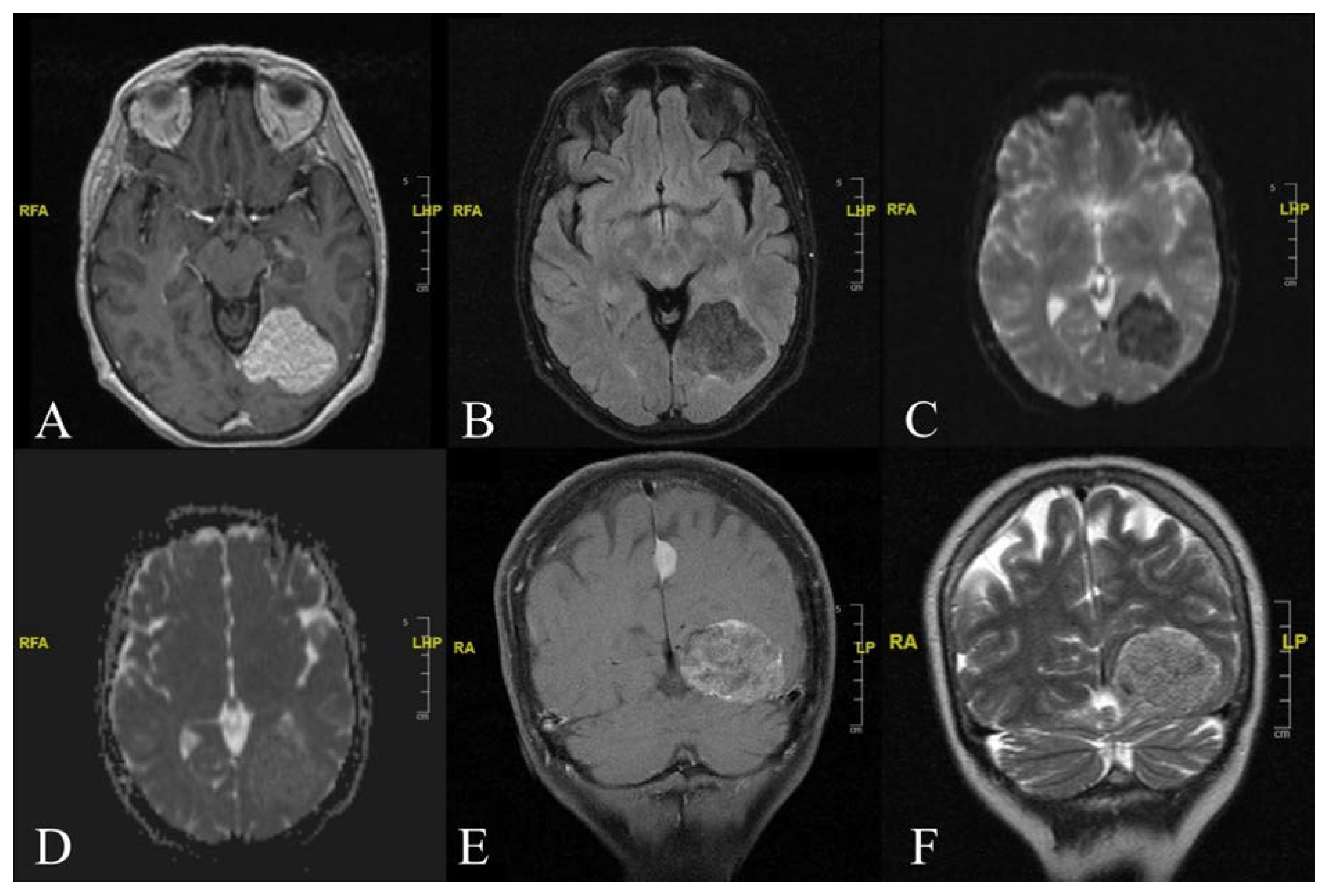 Diagnostics 12 00365 g001