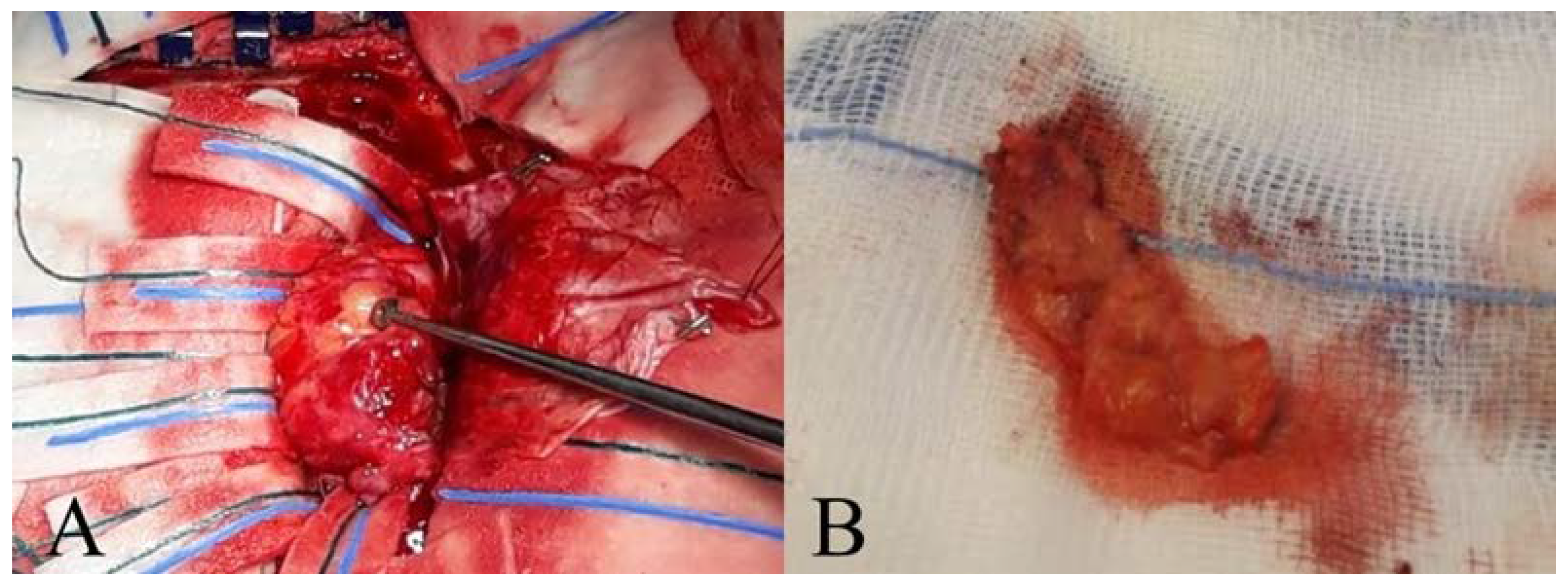 Diagnostics 12 00365 g002