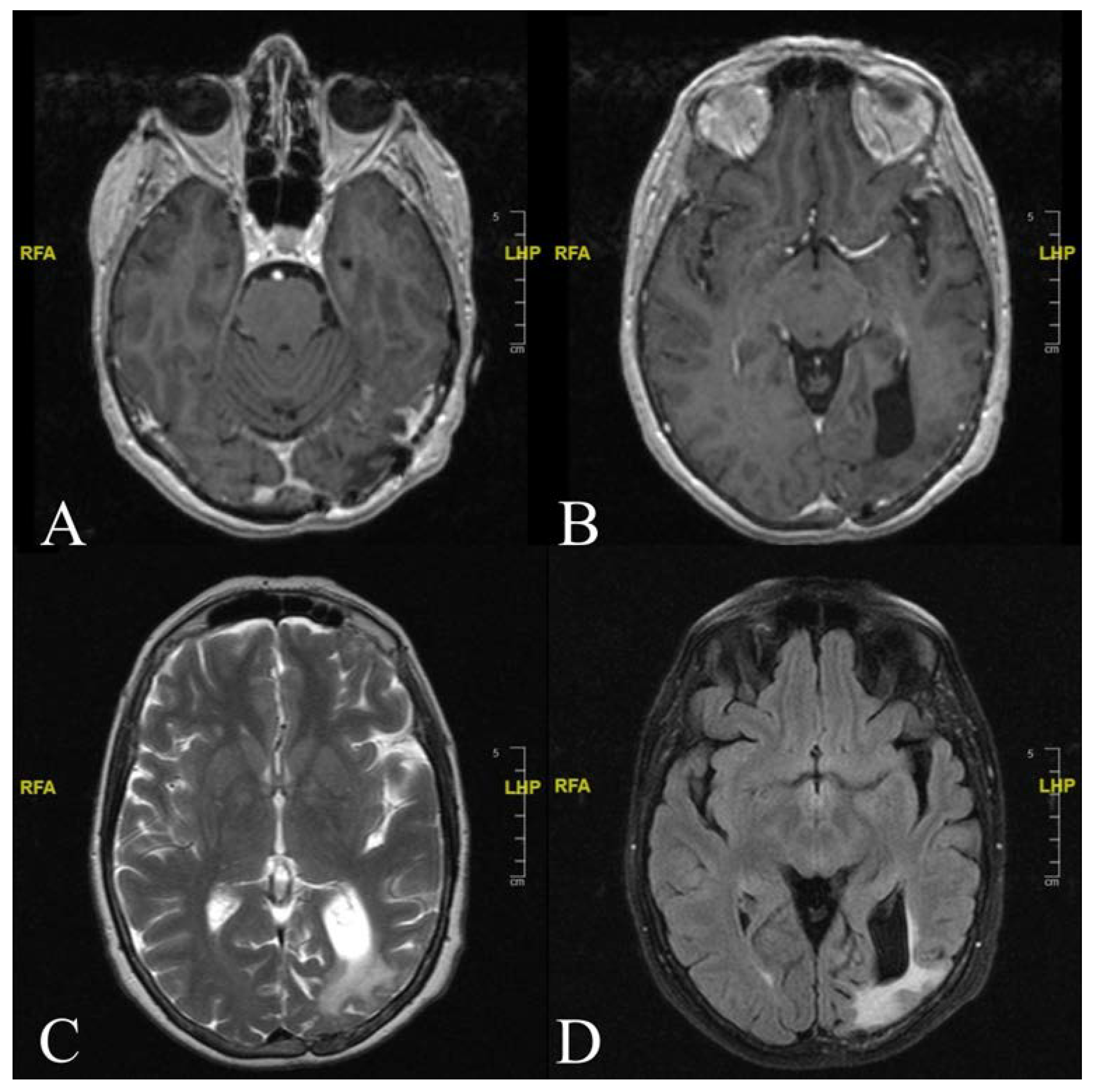 Diagnostics 12 00365 g004