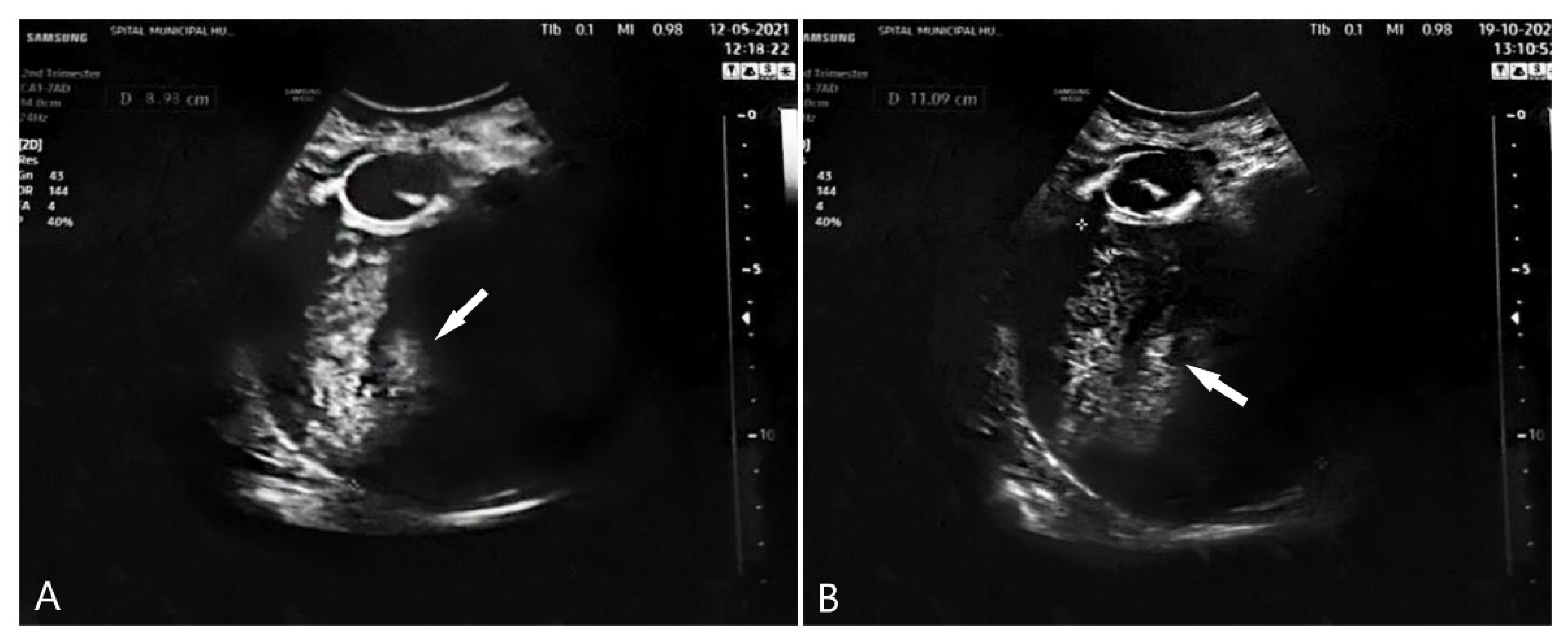 Diagnostics 12 00368 g004